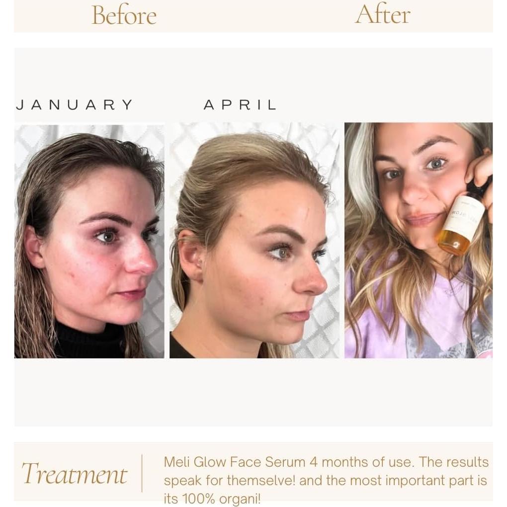 Aceite de Vitamina E y Nuez Kukui 118 ml - Ph Design Organics