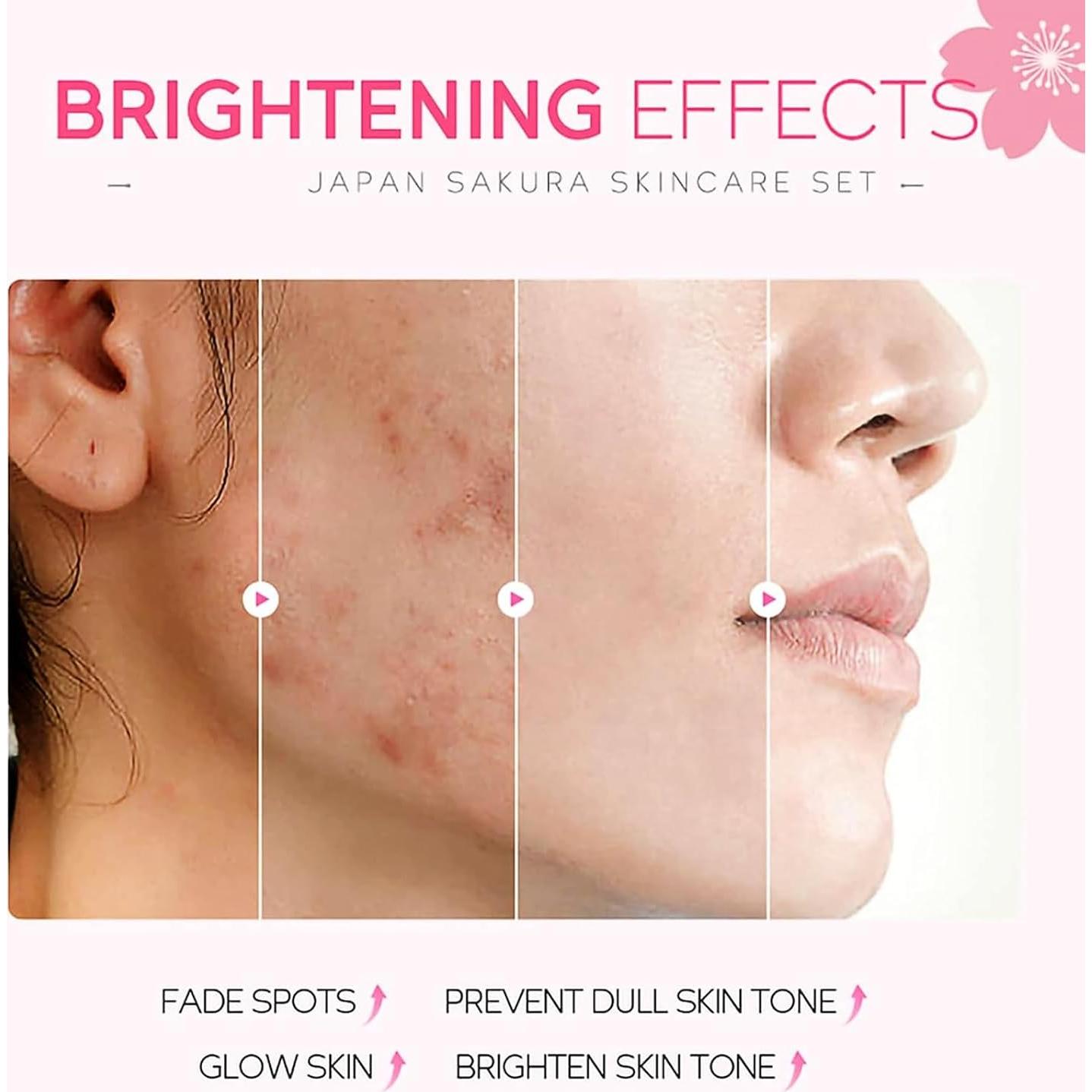 Set de Cuidado Facial 5 Piezas Minfei con Extracto de Sakura