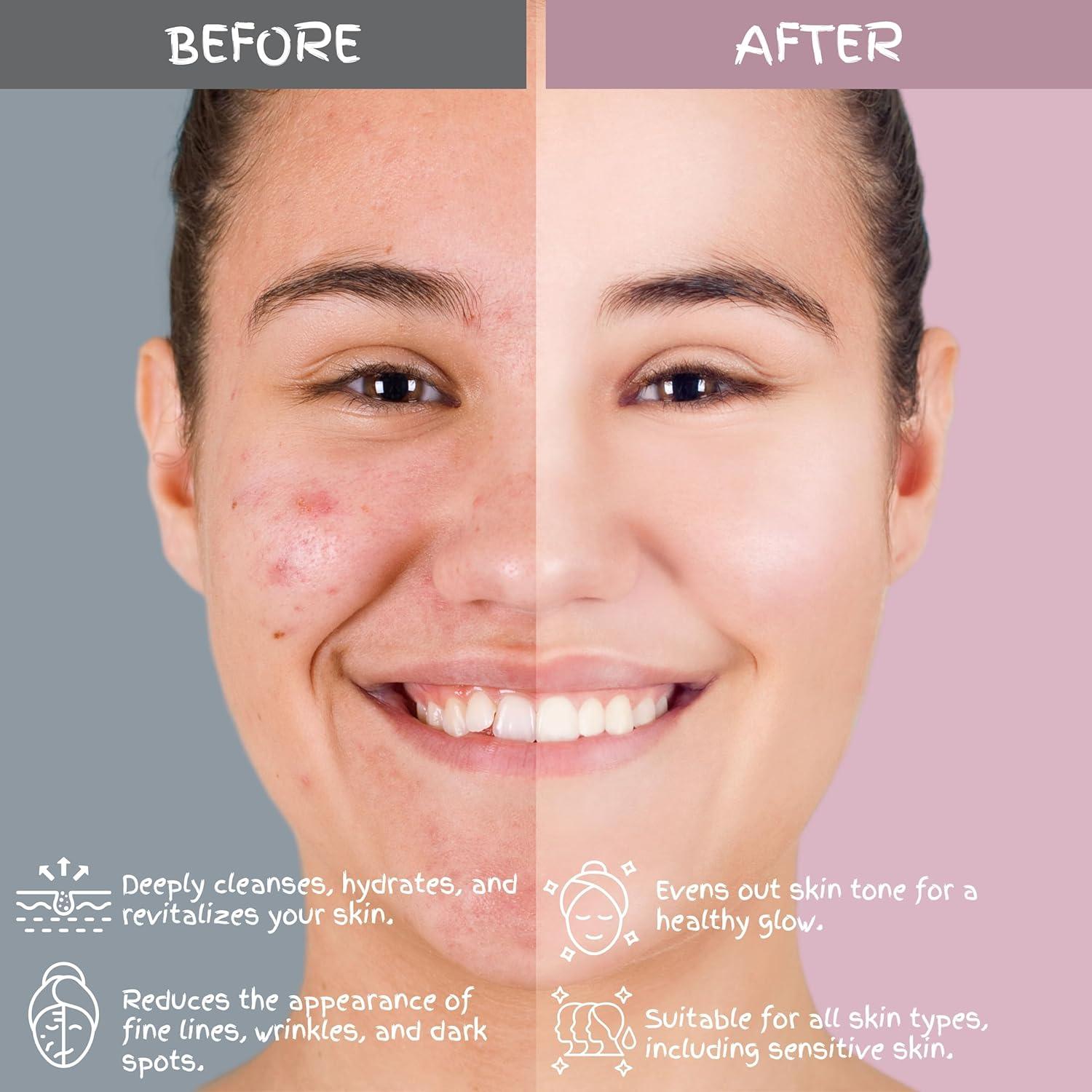 Juego de Cuidado Facial Pulkrify 6 Piezas Flor de Cerezo