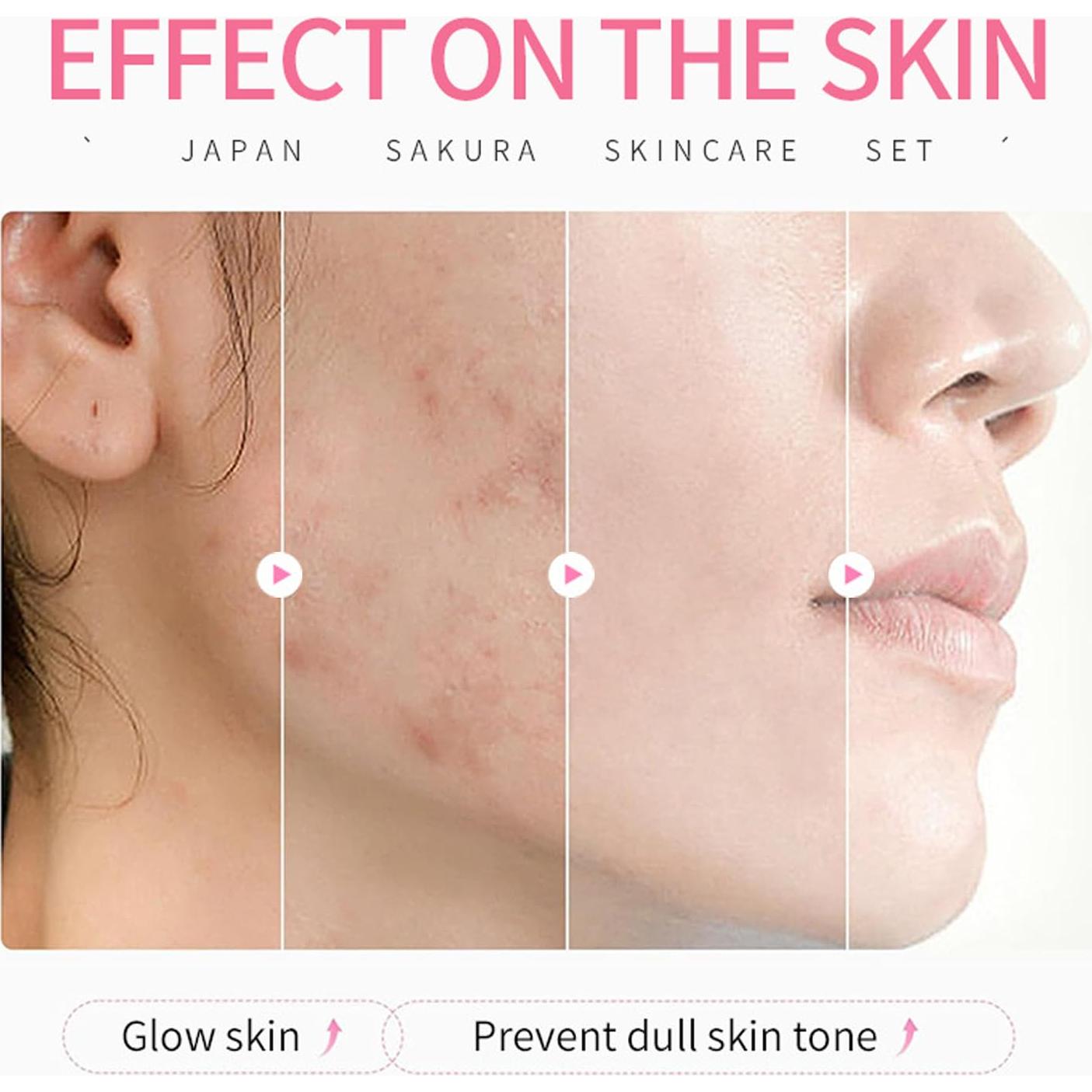 Kit de Cuidado de la Piel JAPAN SAKURA 4 Piezas Hidratante