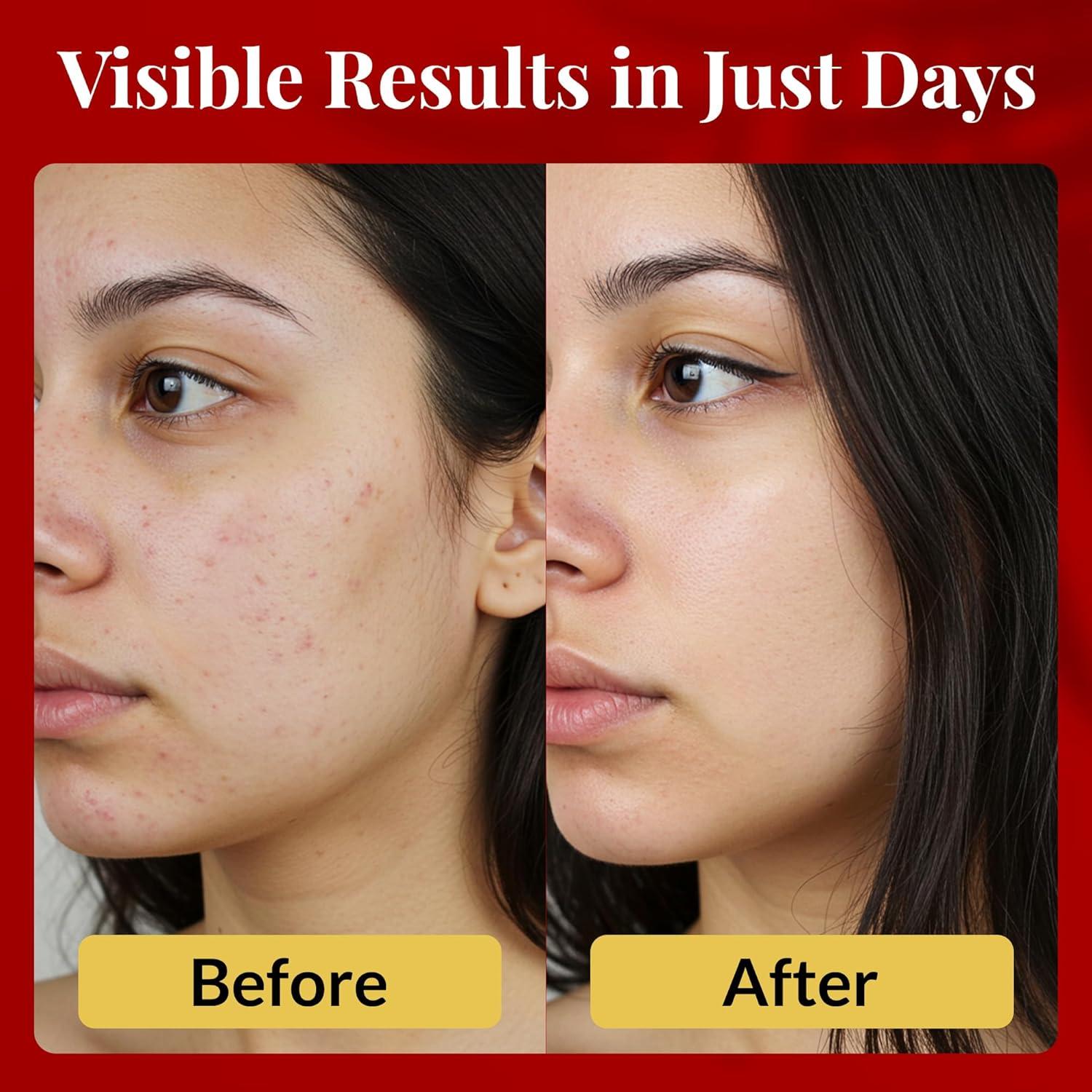 Jabón Face Doctor 95g para Acné y Rosácea - Piel Sensible