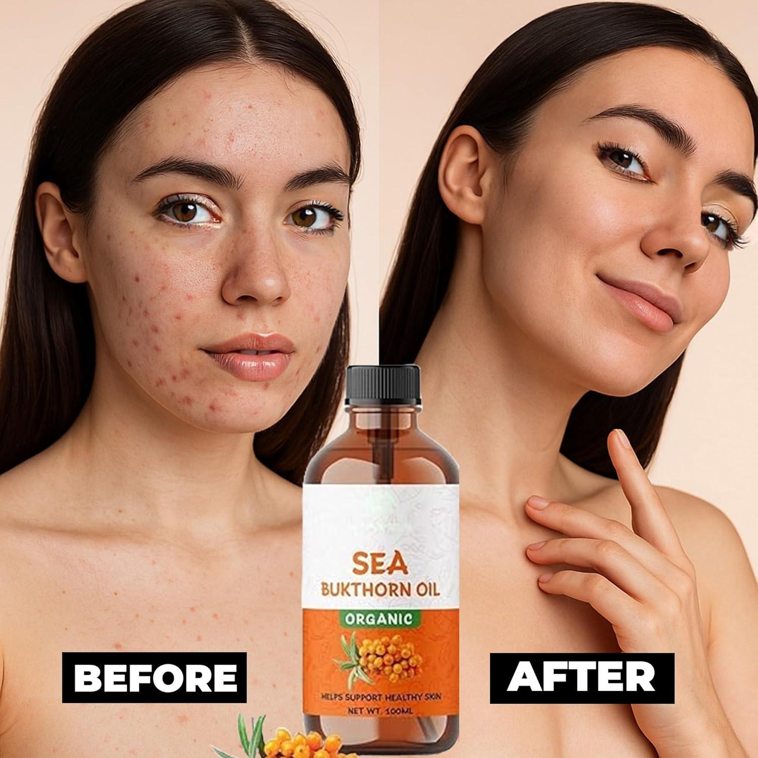 Aceite de Espino Marino 100ml ABBASI & CO Puro y Virgen