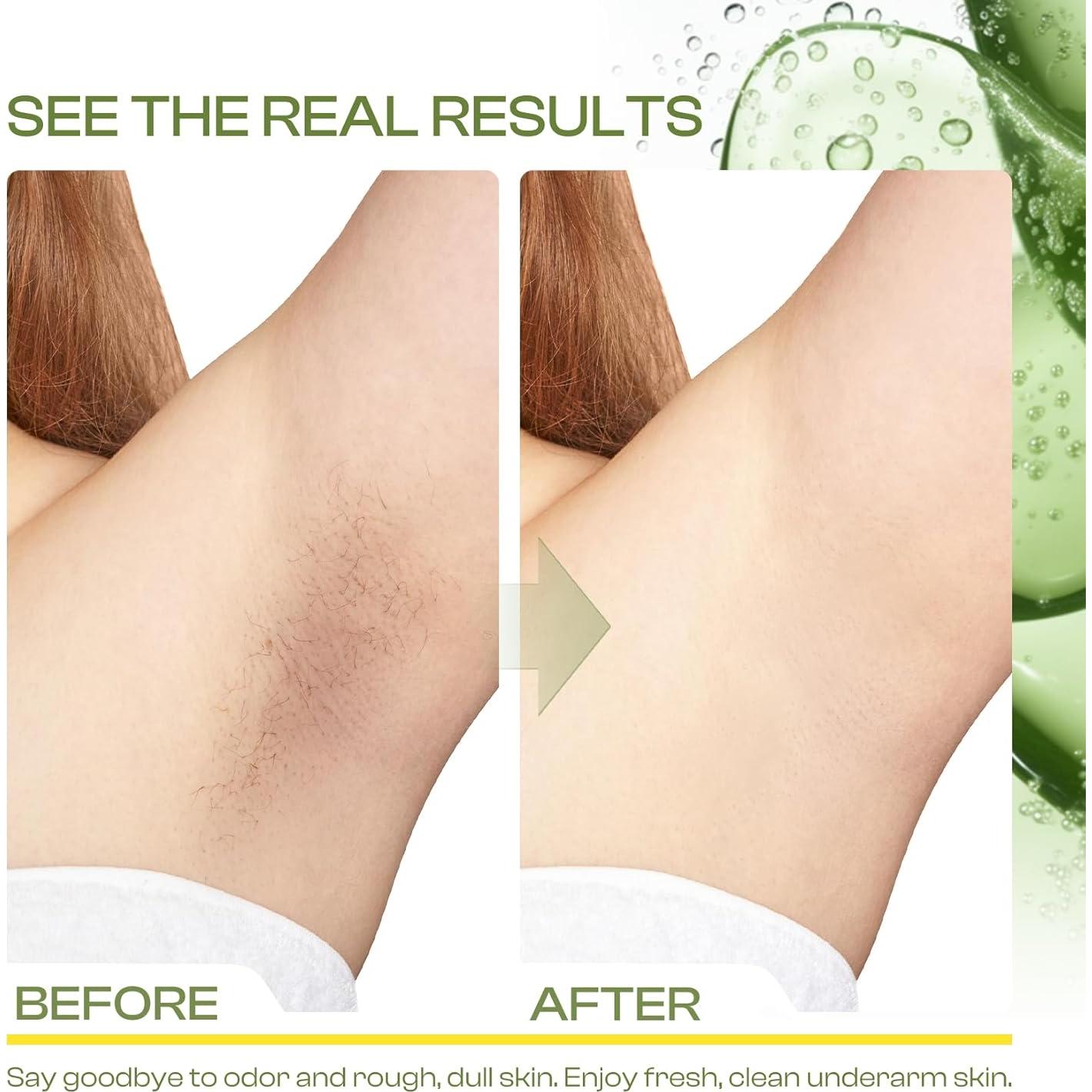 Exfoliante Detox para Axilas Jtopyrt con Menta y Centella