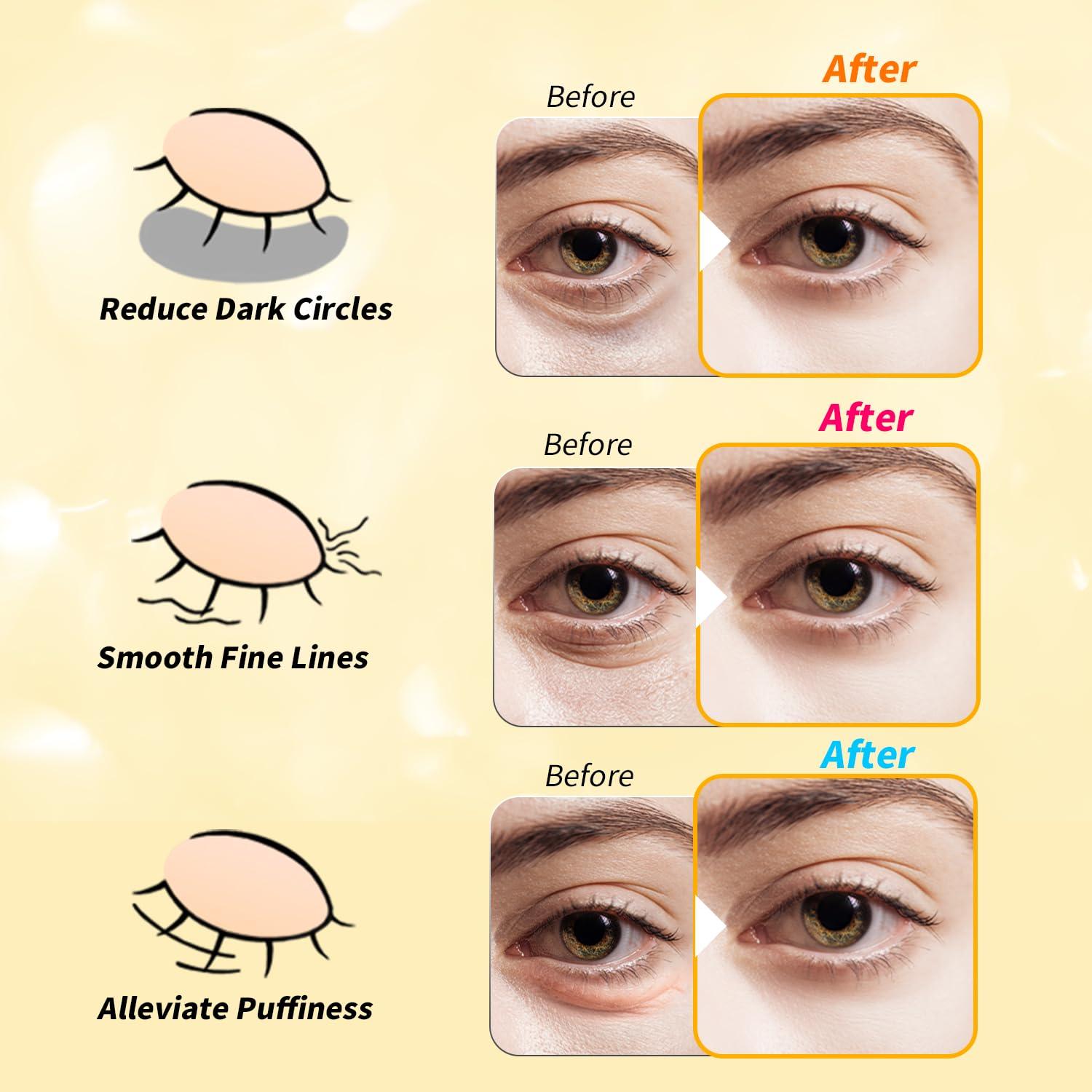 Parche para Ojos Tibobo - 12 Pares Oro 24K, Retinol, Cafeína