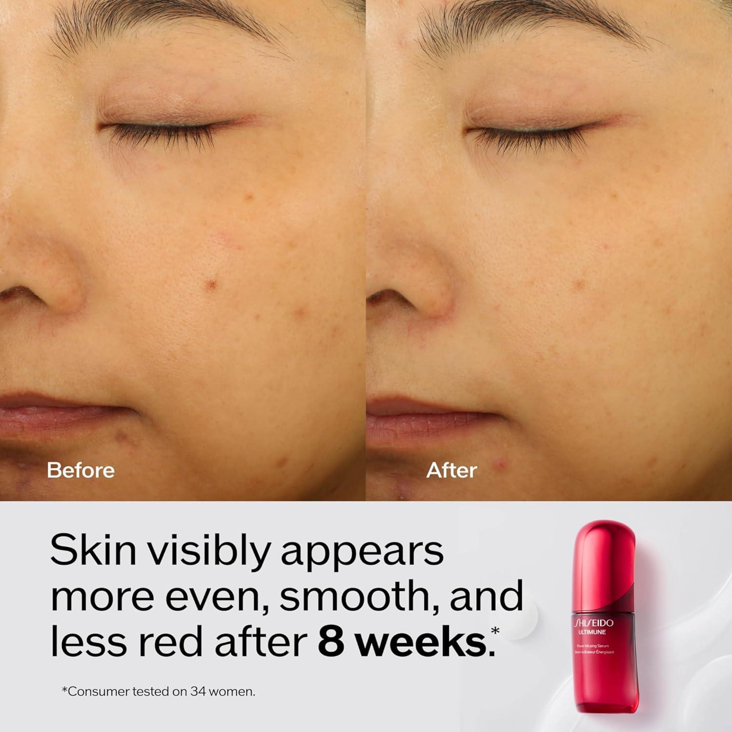 Suero Facial Ligero Shiseido Ultimune 28.35 ml - Antiaging