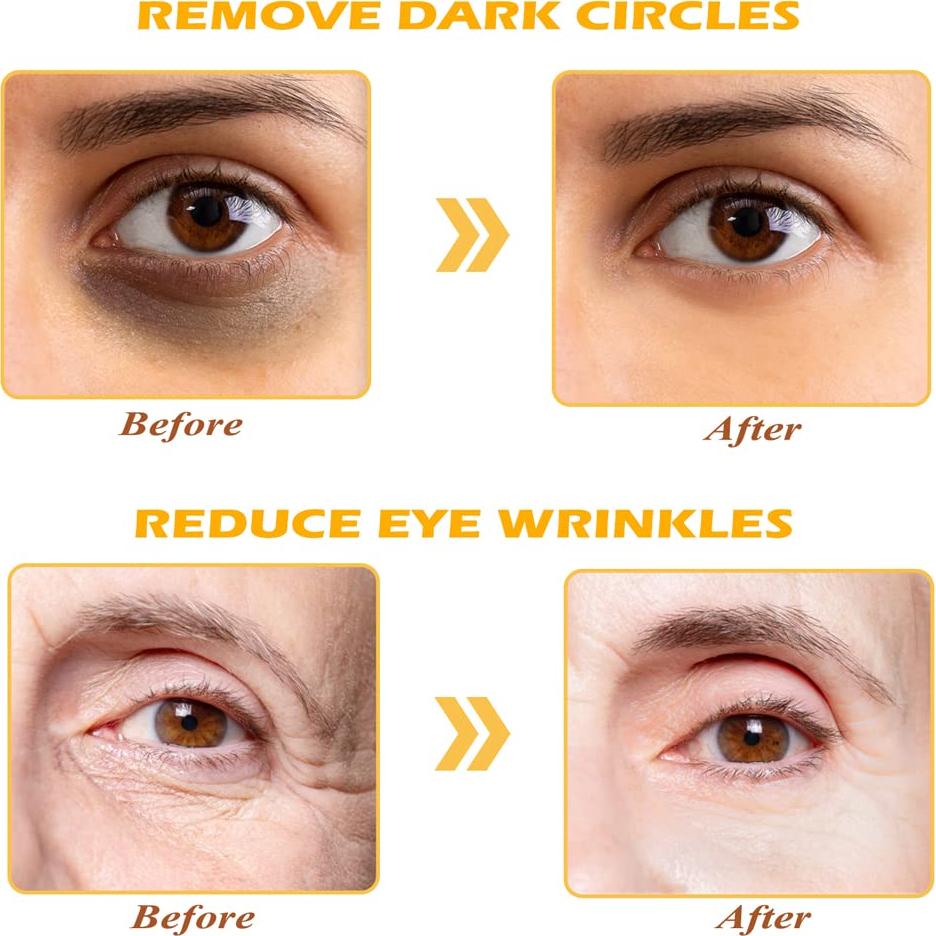 Mascarilla de Ojos de Oro 24K Devimic - 30 Pares Hidratantes