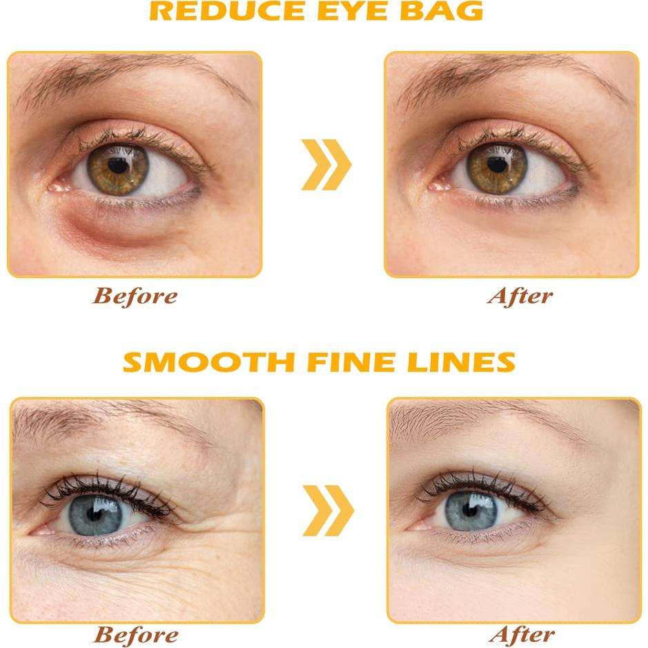 Mascarilla de Ojos de Oro 24K Devimic - 30 Pares Hidratantes