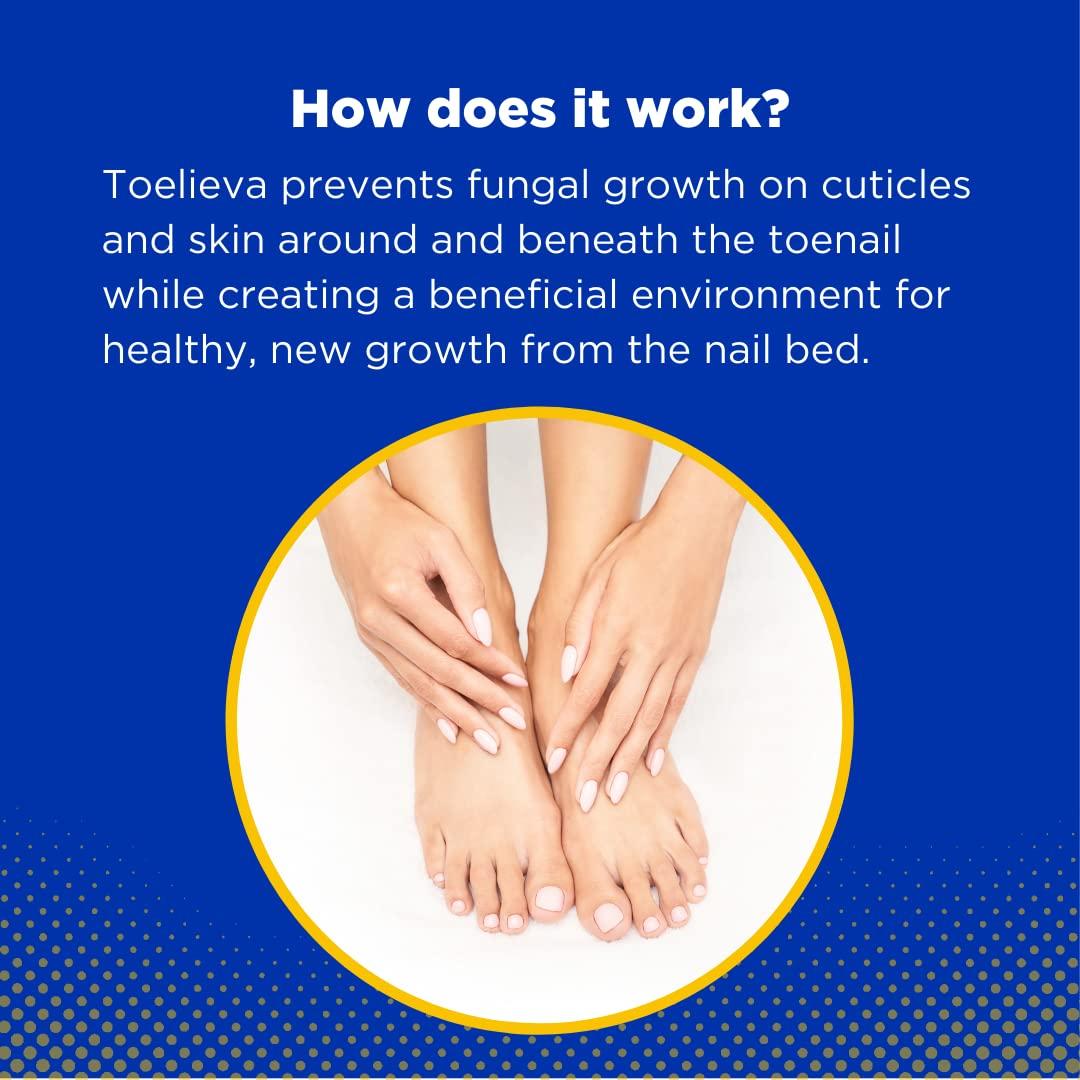 Toelieva Antifúngico Líquido Baar - 59 ml - 25% Ácido Undecilénico
