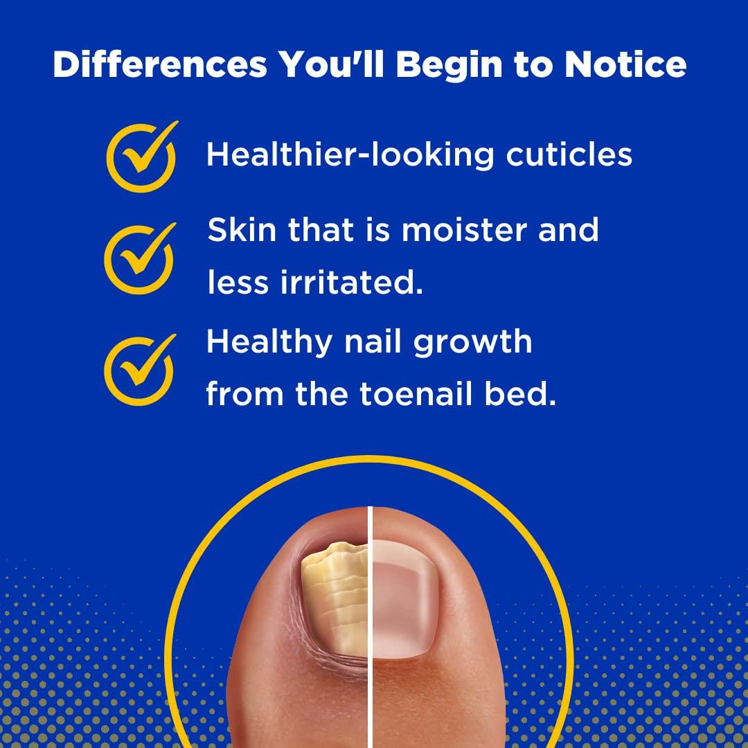 Toelieva Antifúngico Líquido Baar - 59 ml - 25% Ácido Undecilénico