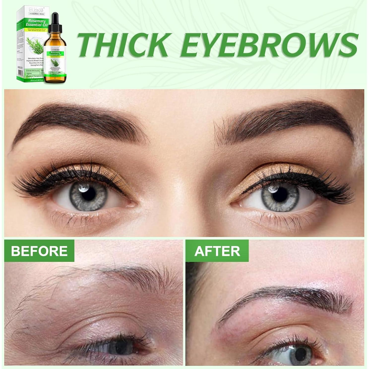 Aceite Esencial de Romero Puro ELBBUB 60ml - Crecimiento Cabello