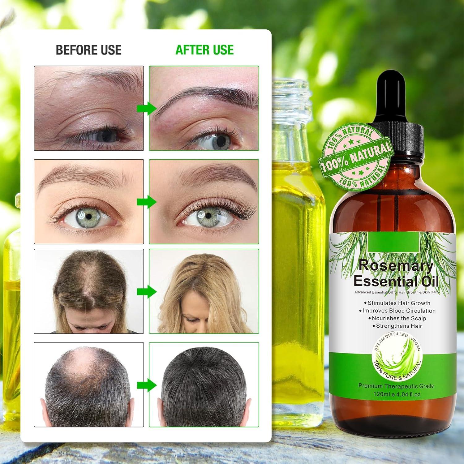 Aceite de Romero Puro 120 ml - Crecimiento Cabello y Piel