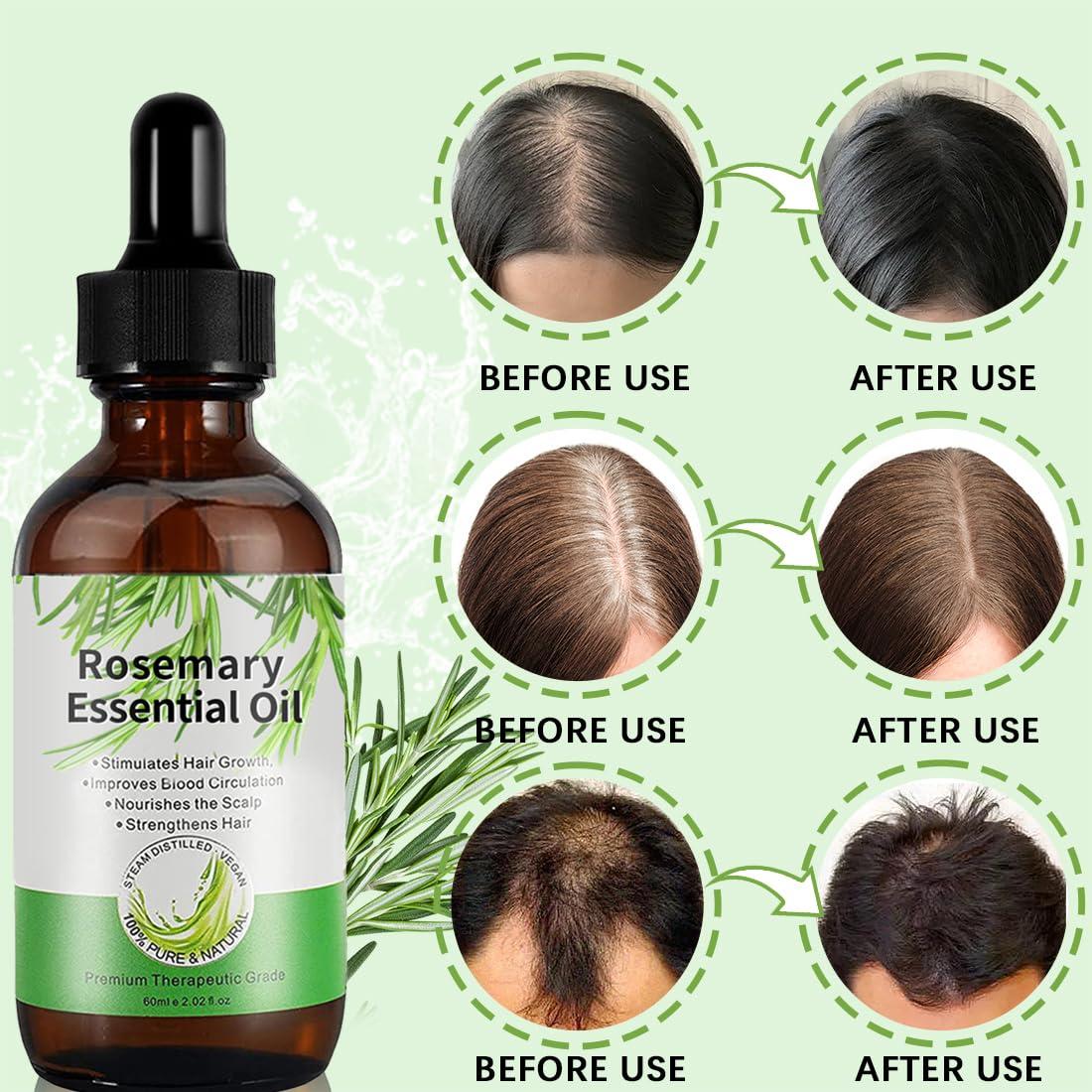 Aceite de Romero GOFLORDEN 120ML para Crecimiento Cabello