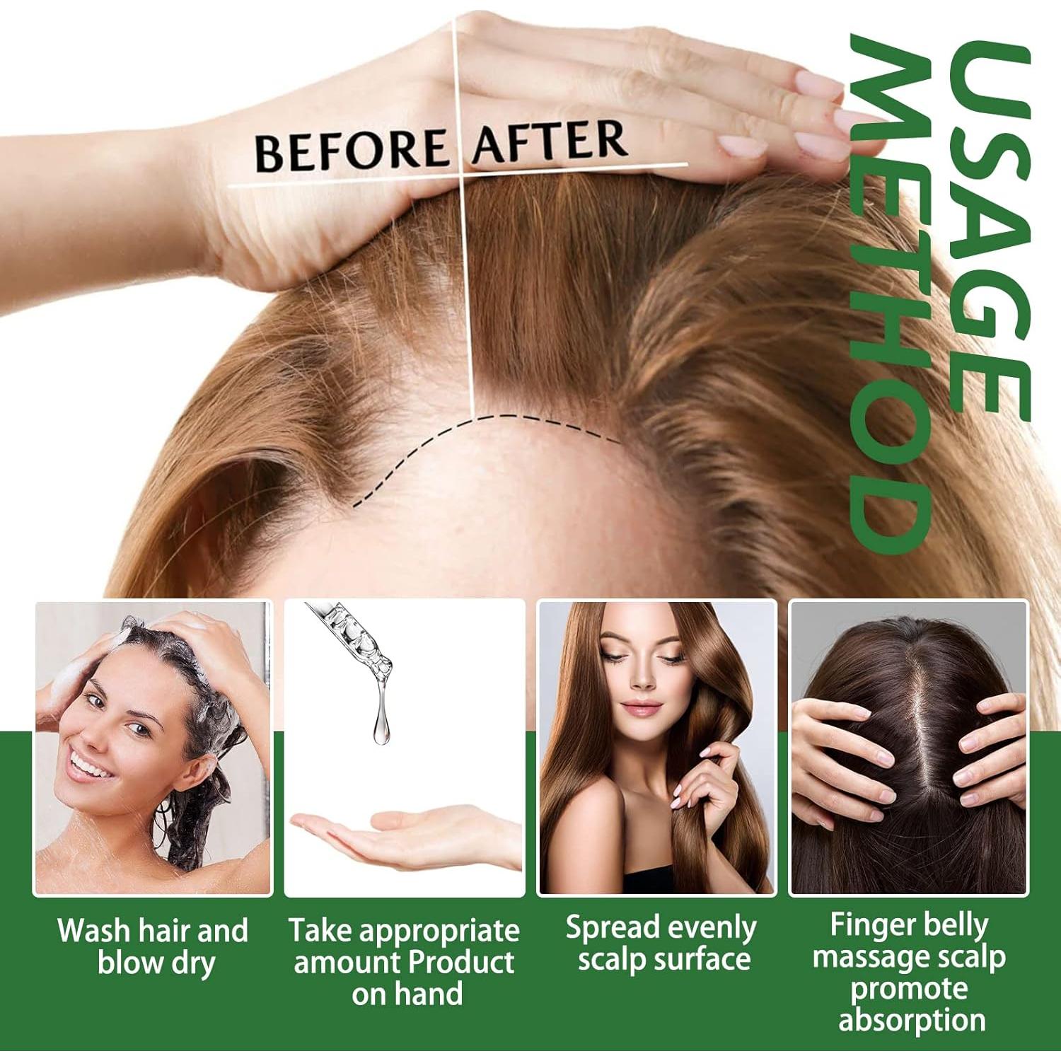 Aceite de Romero GOFLORDEN 120ML para Crecimiento Cabello