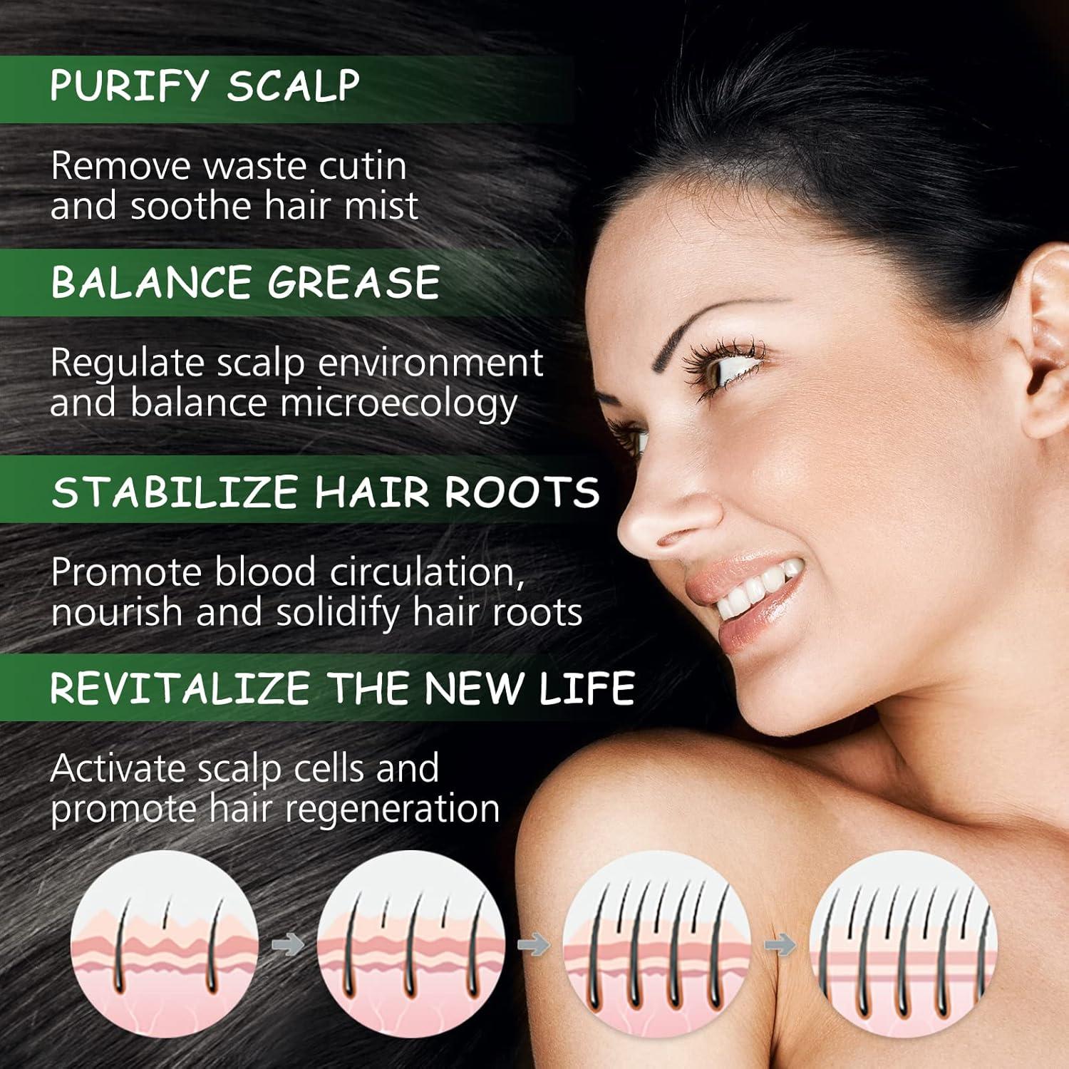 Aceite de Romero GOFLORDEN 120ML para Crecimiento Cabello