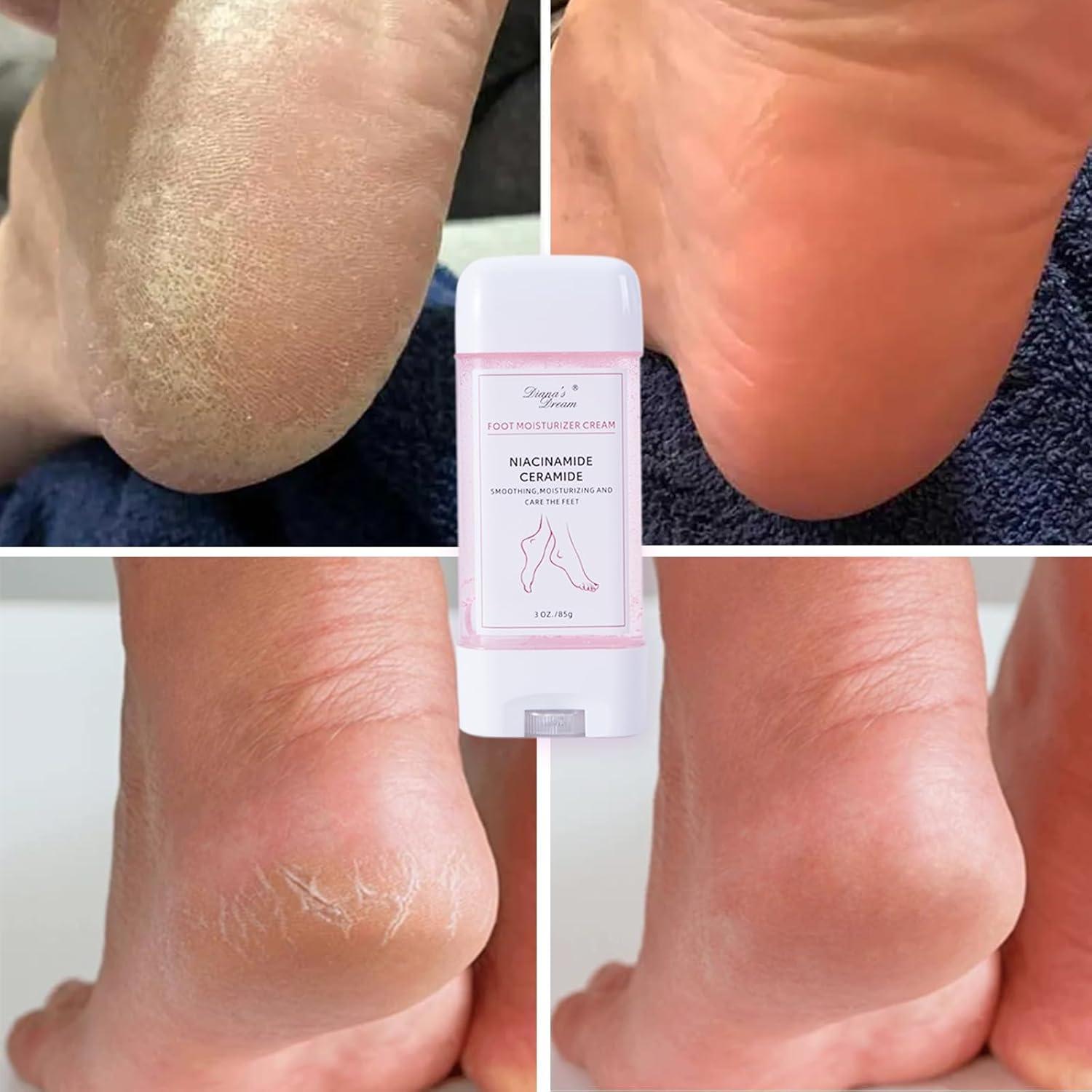 Crema Ultra-Hidratante SUEÑO DE DIANA para Pies Agrietados 85g