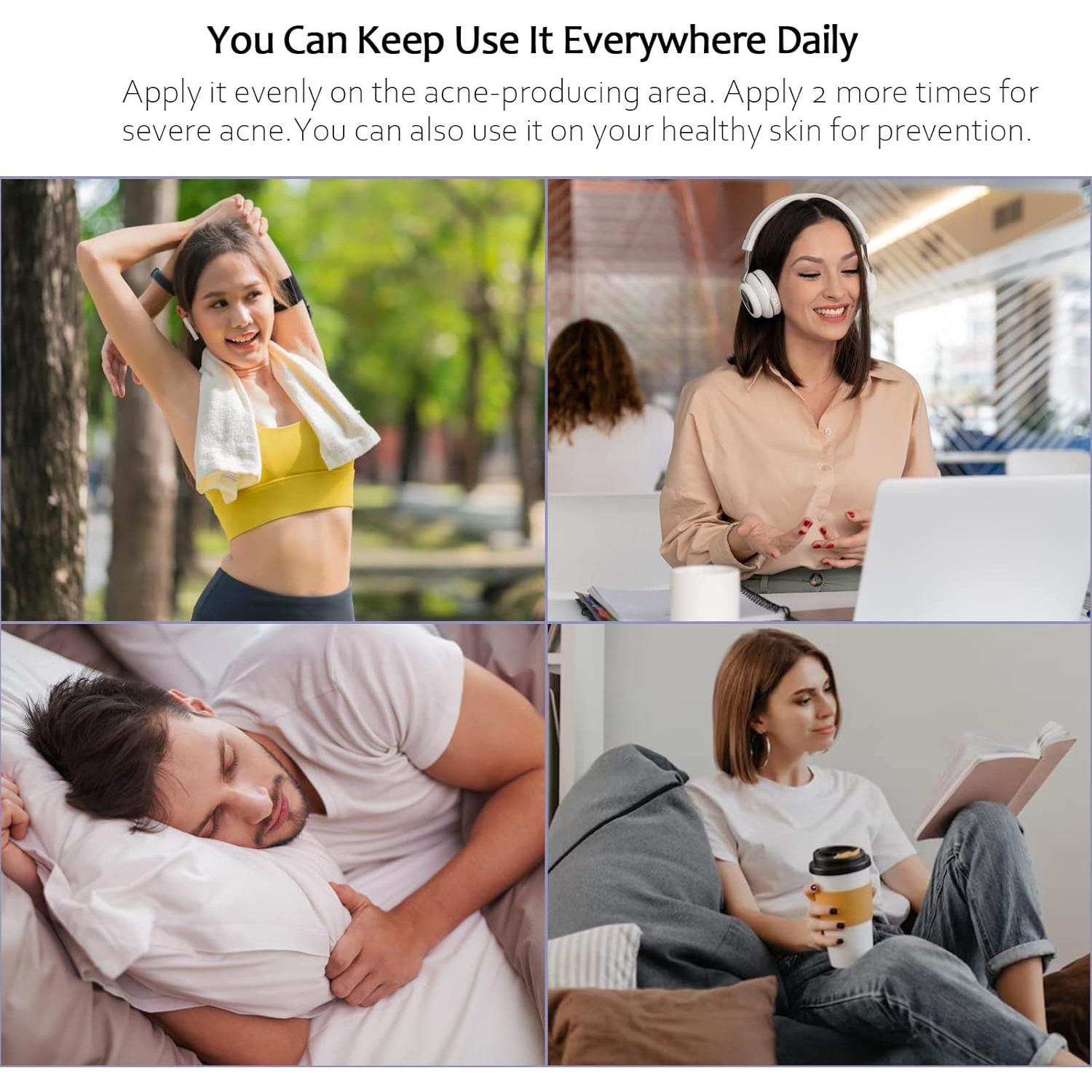 Crema Corporal Antiacné Loción Loción 130g para Espalda y Glúteos