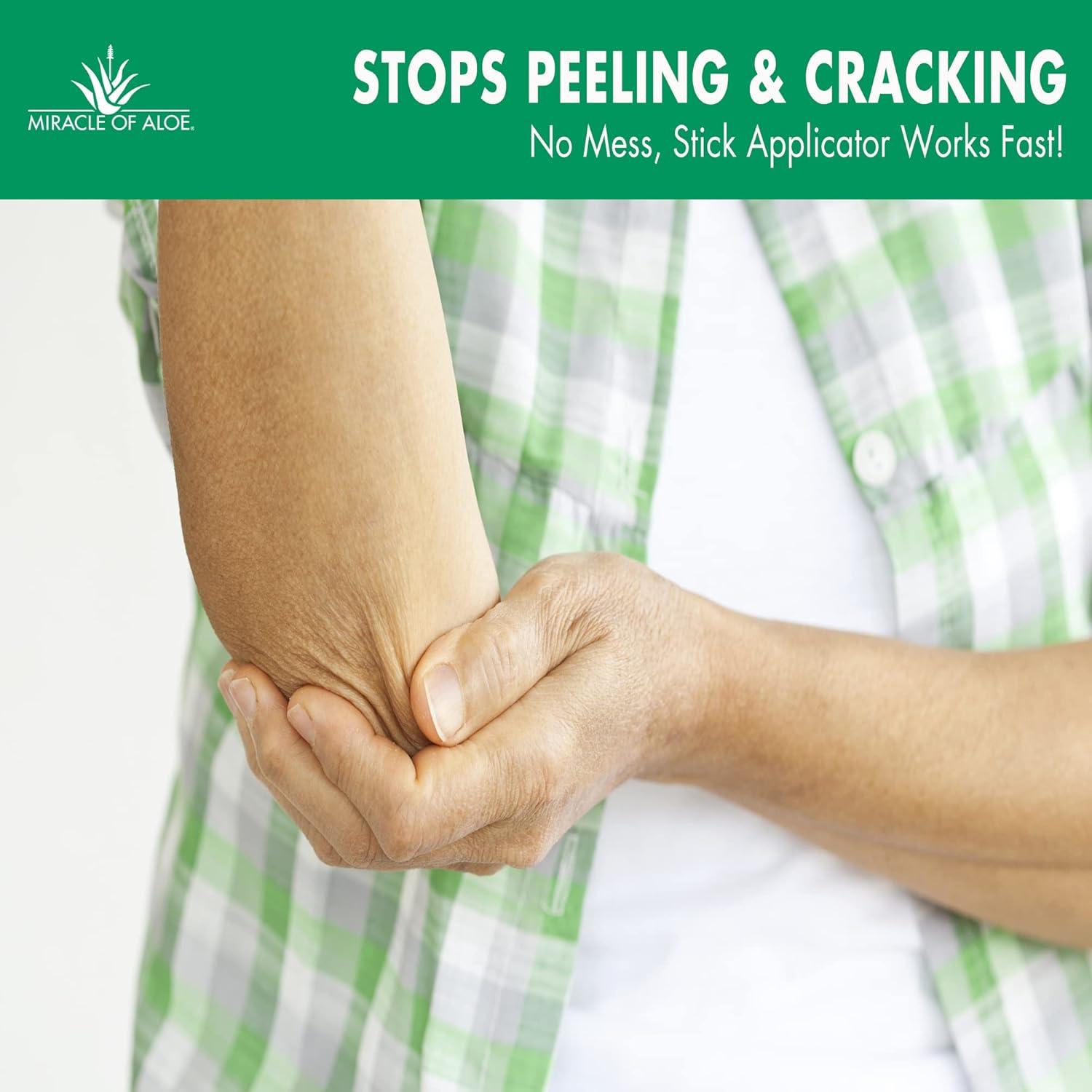 Bastón Milagroso para Rodillas y Codos Aloe Vera 70.87 g