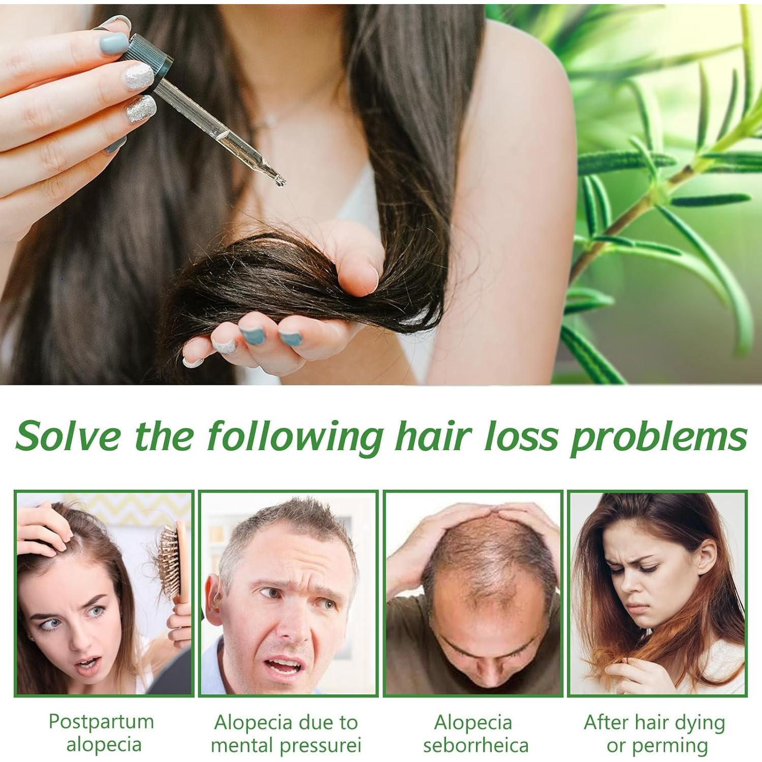 Aceite Esencial de Romero ELBBUB 120ml - Crecimiento Cabello y Piel