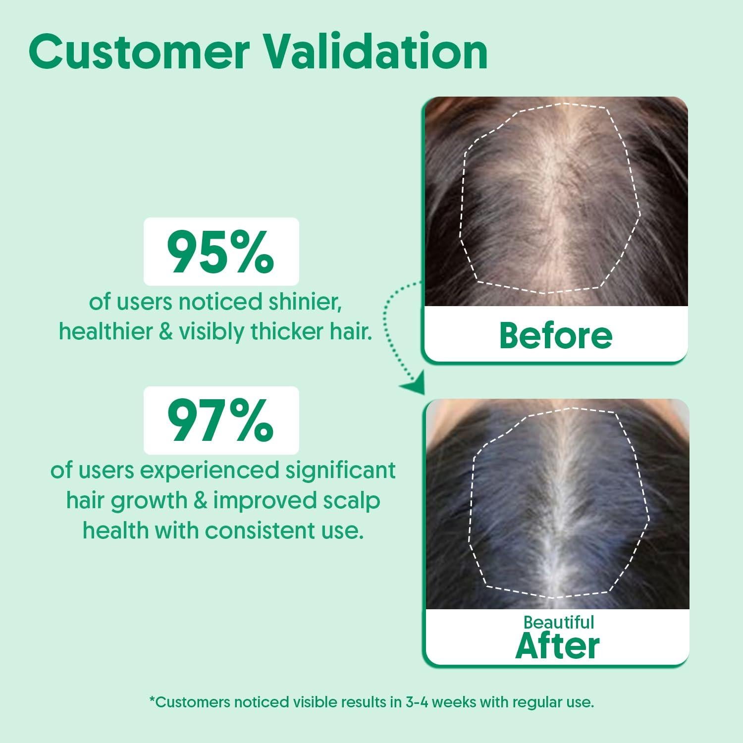 Aceite Esencial de Romero Orgánico 30ml - Crecimiento y Cuidado del Cabello