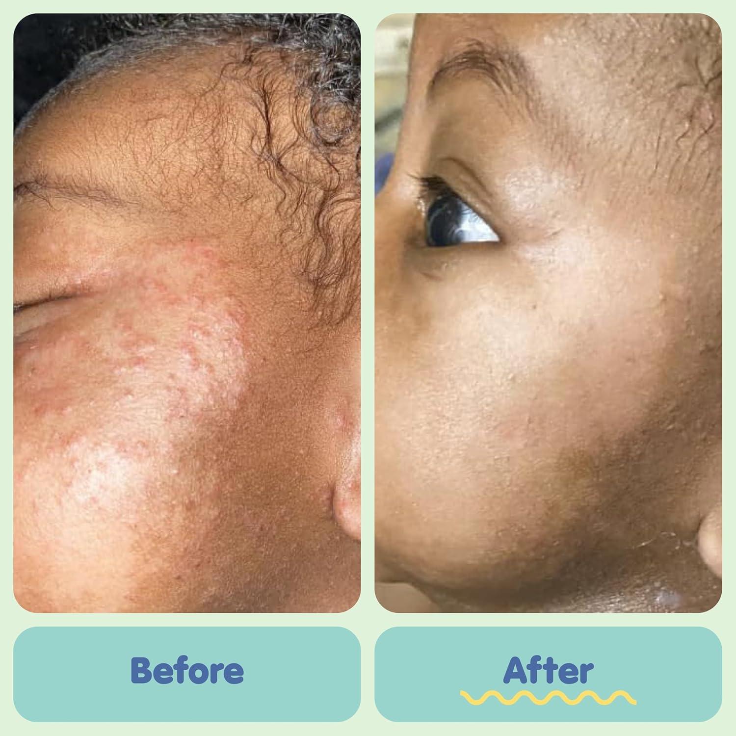 TUBBY TODD Set de Cuidado de Piel para Bebés - Jabón Hipoalergénico y Ungüento