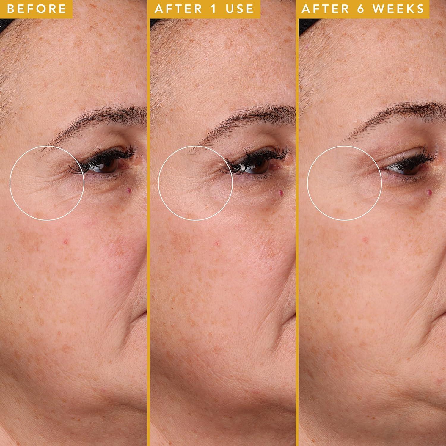 Suero Antienvejecimiento Farmacy Filling Good 30ml - Ácido Hialurónico