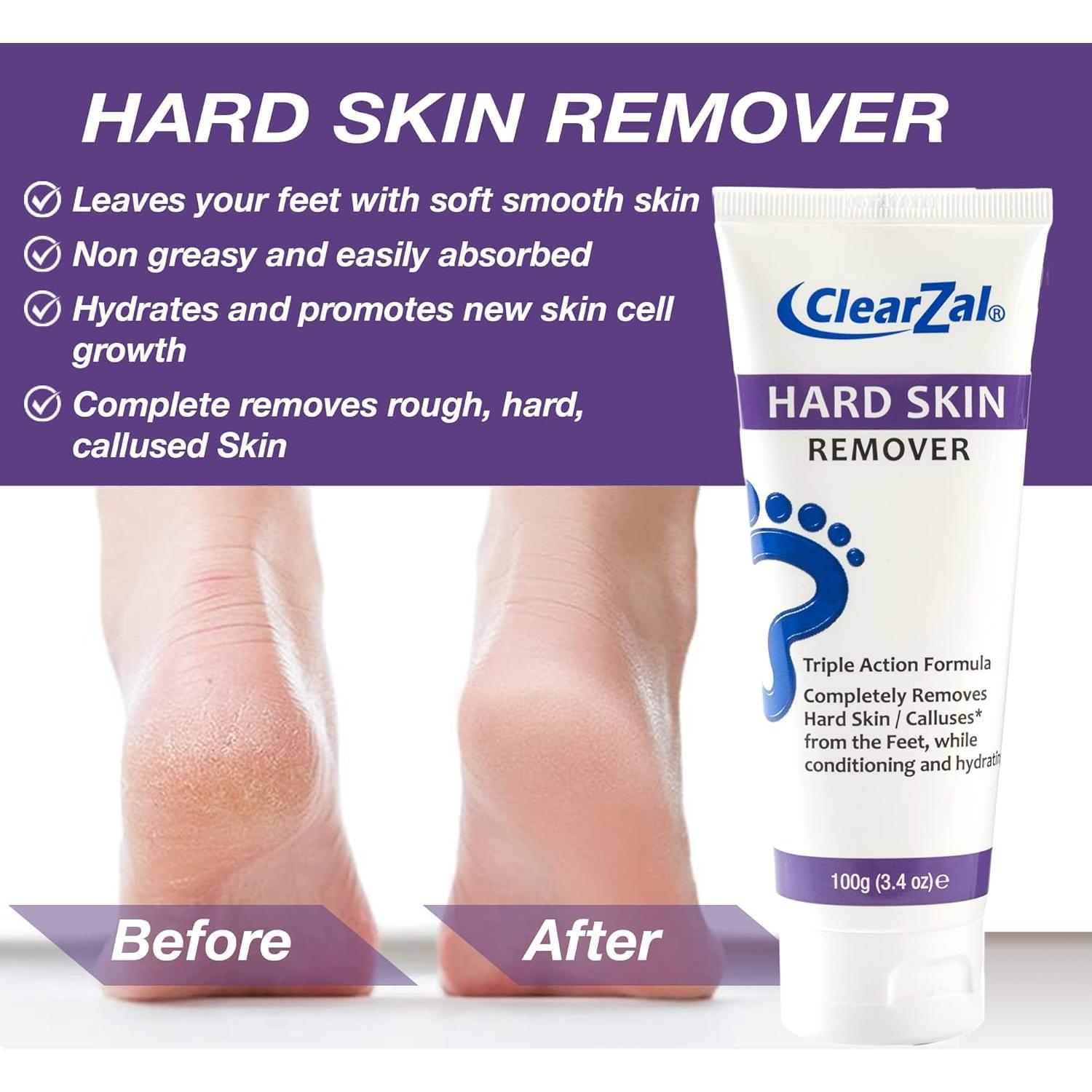 Crema para Pies ClearZal 96g - Hidratante con Aloe Vera