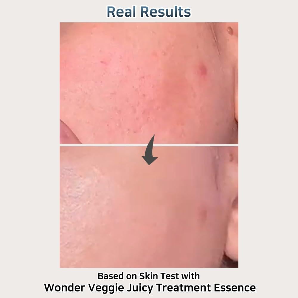 Tónico Hidratante Facial Hersteller 150 ml - Vegano, K-Beauty