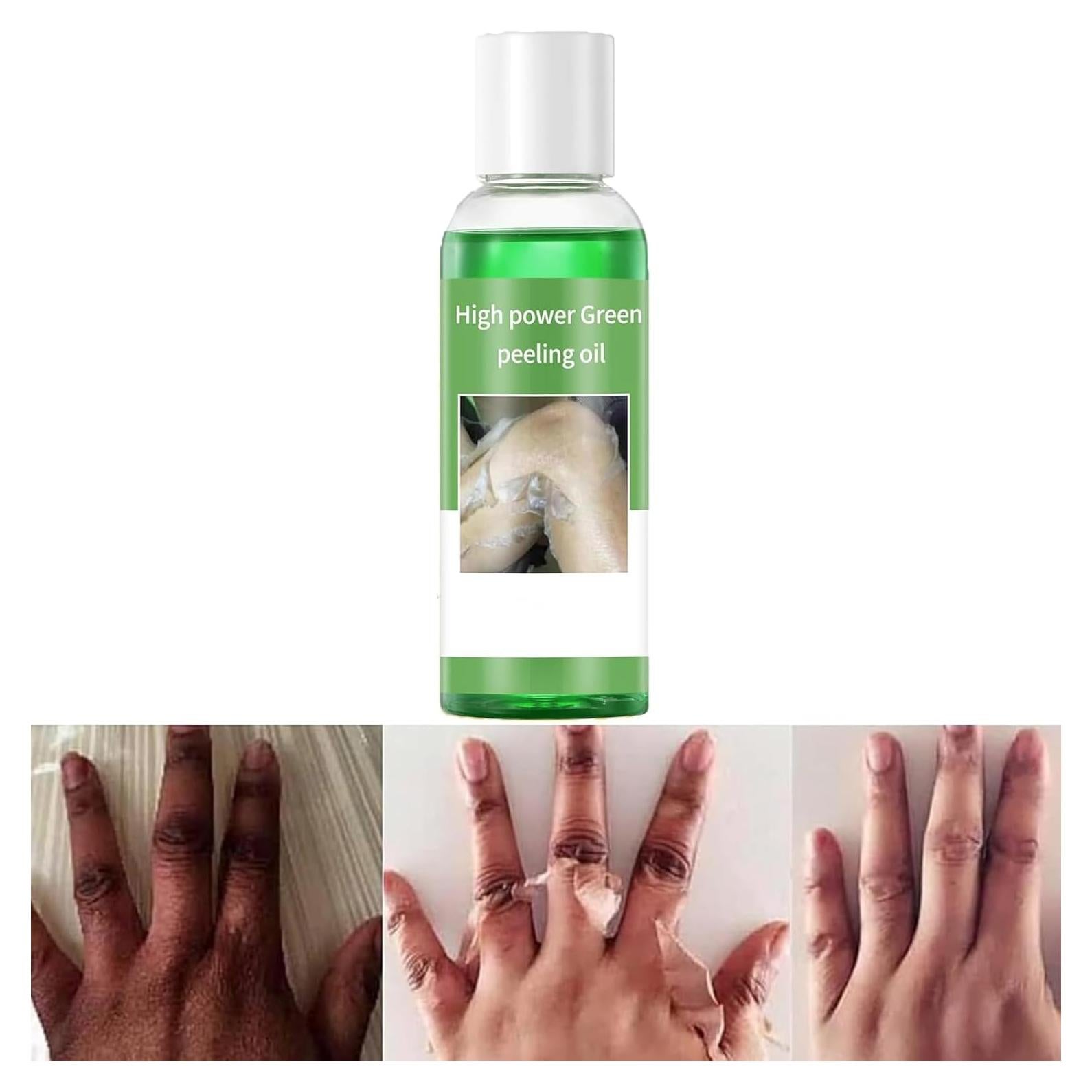 Aceite Exfoliante Verde Genérico 110ml - Piel Radiante y Suave