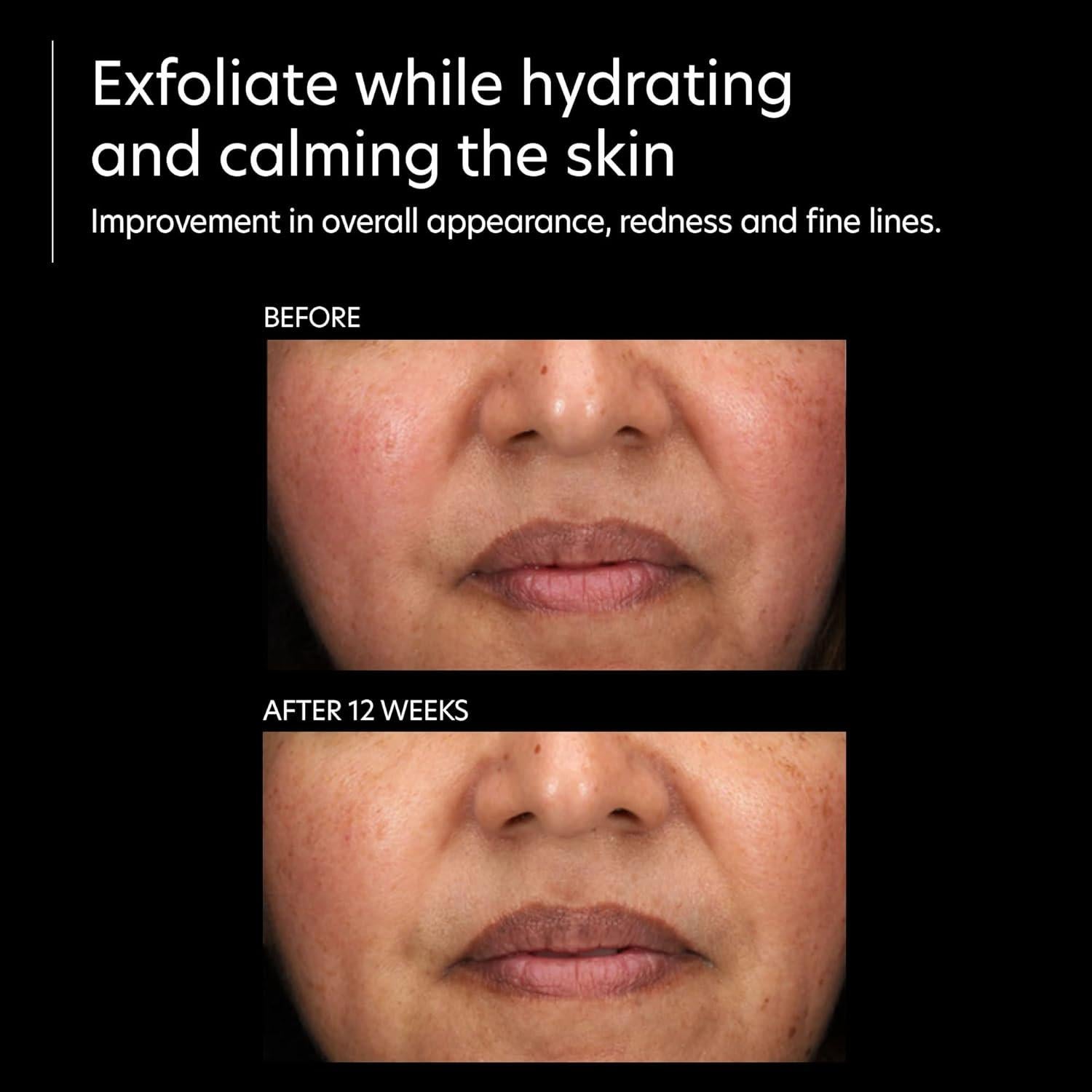 Suero Exfoliante PCA SKIN 29.57 ml - Ácido Láctico y Glicólico