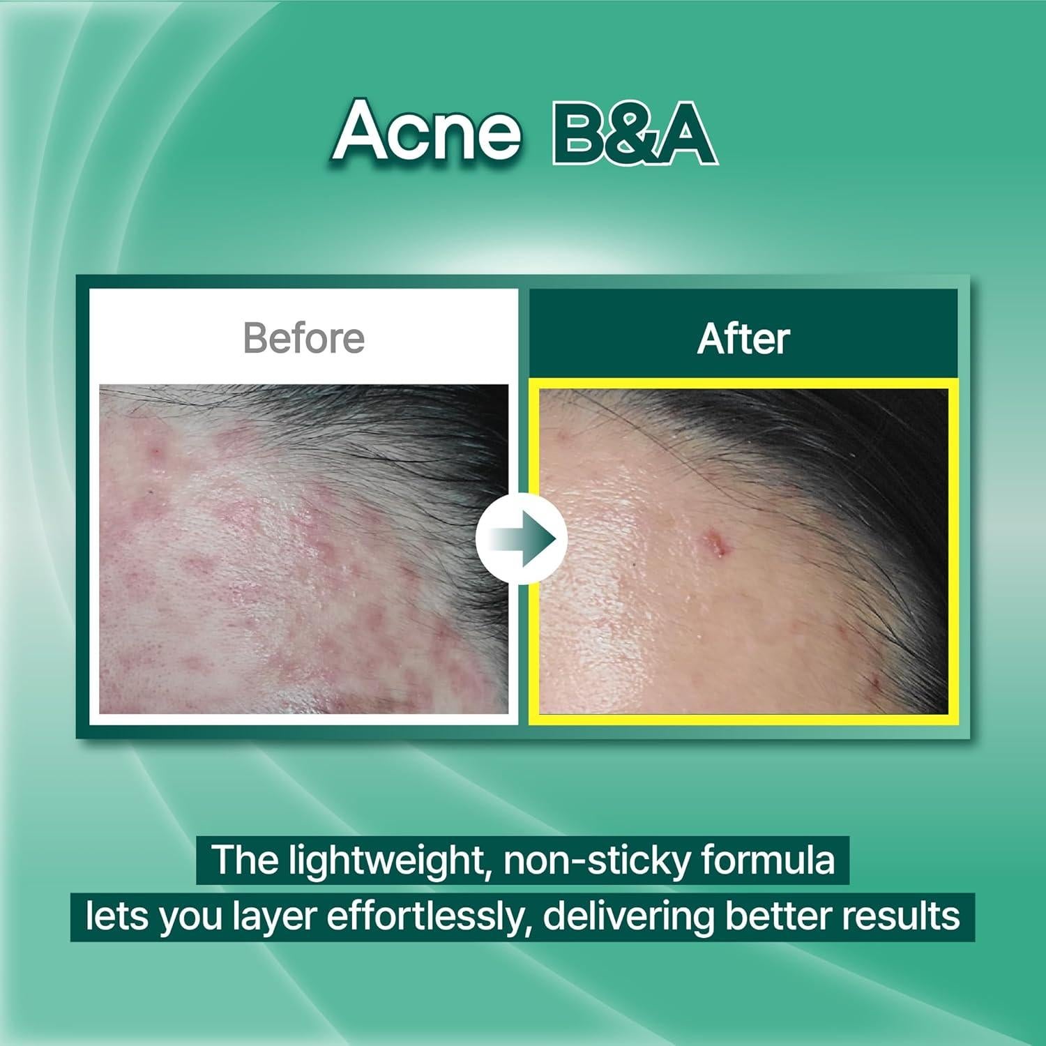 Esencia Facial Calmante Regaliz Coreano 100g - Hidratante Ligero