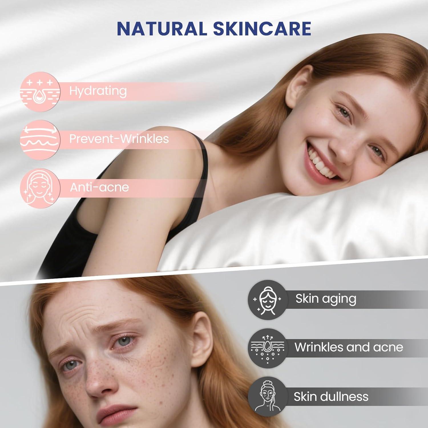 Funda de Almohada de Seda Ravmix Reina 50.8x76.2 cm Blanca