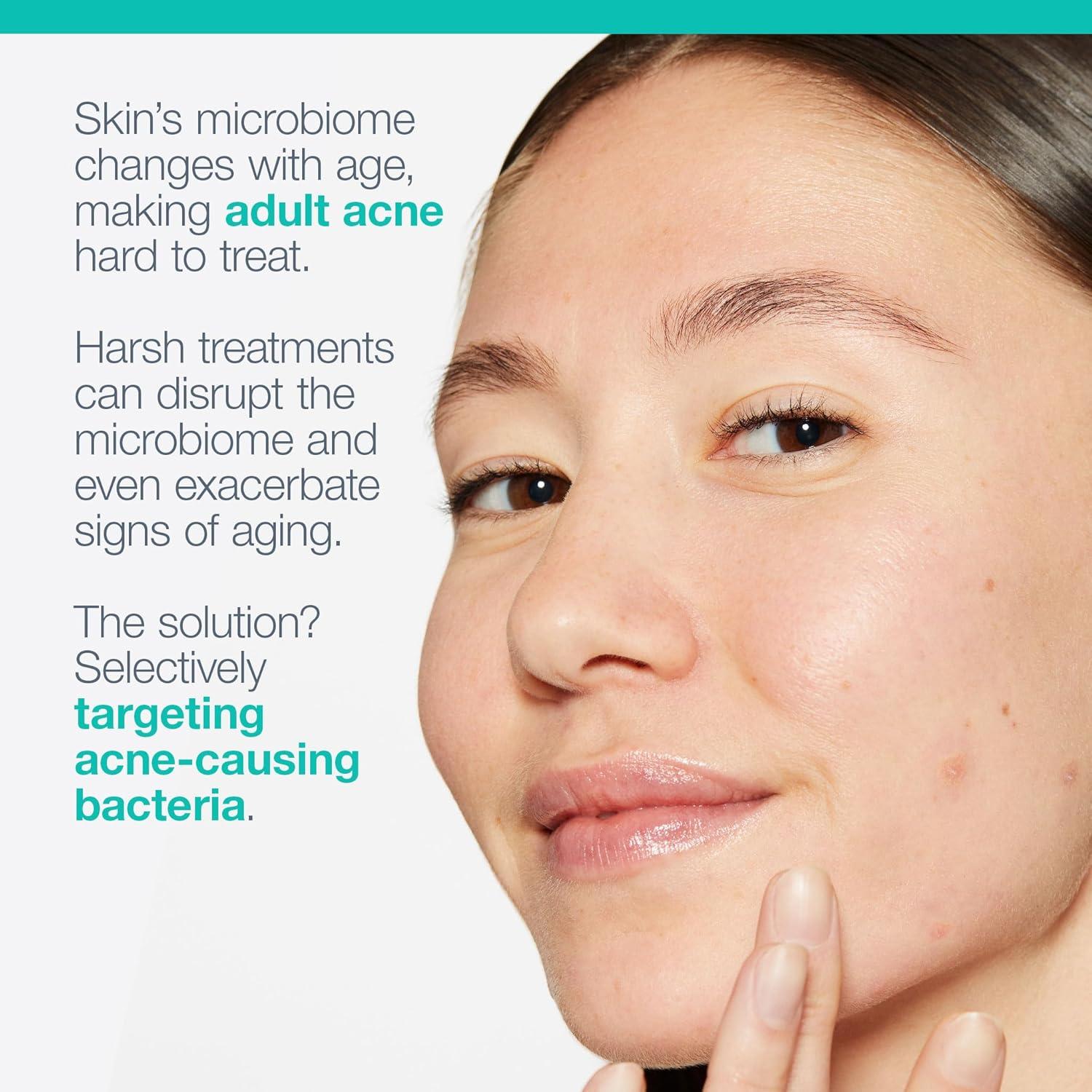 Hidratante Facial Acne Biotic Dermalogica 50 ml - Previene Brotes