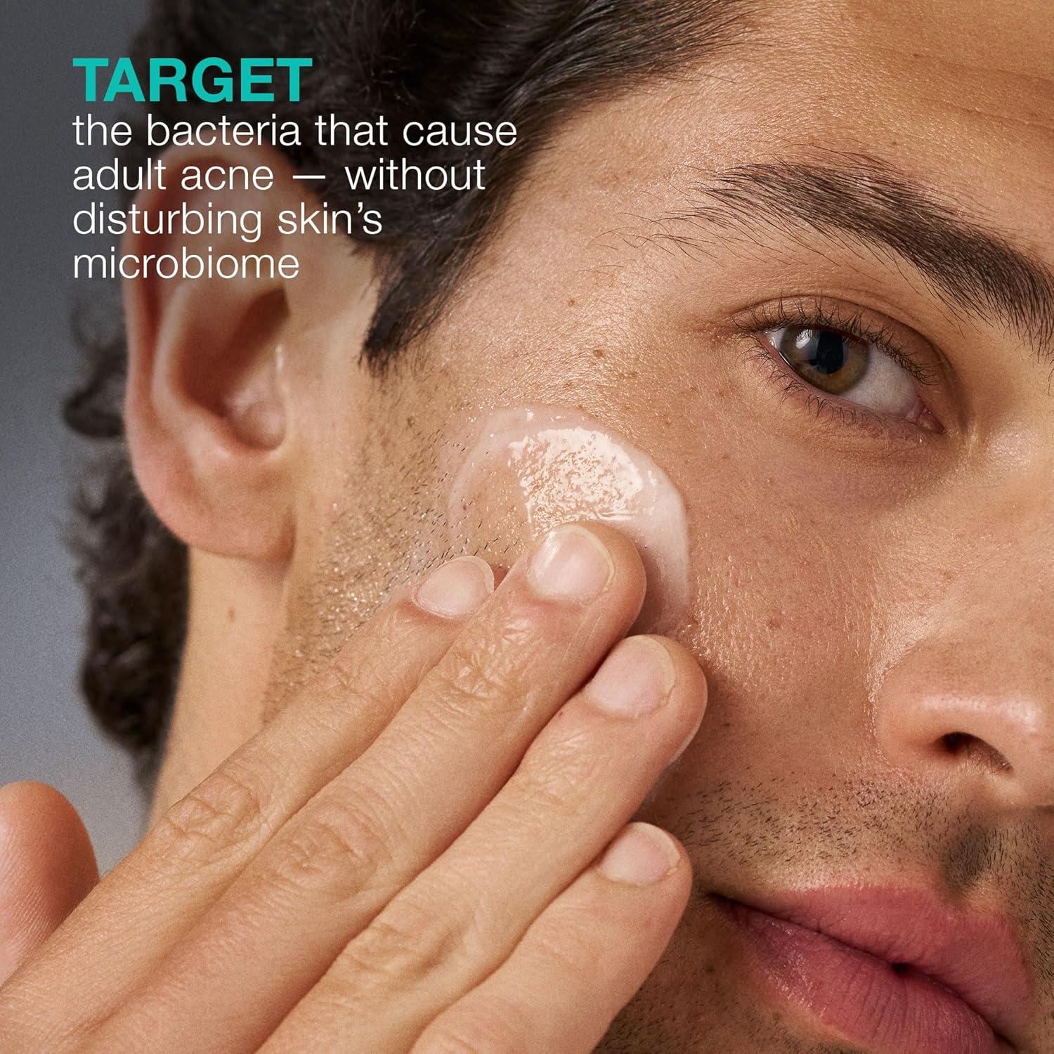 Hidratante Facial Acne Biotic Dermalogica 50 ml - Previene Brotes