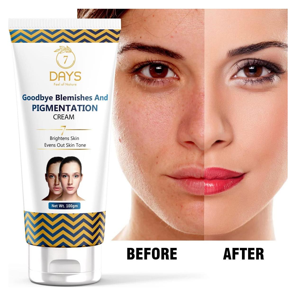 Crema Aclaradora Bye Bye - 100g, Elimina Manchas Oscuras