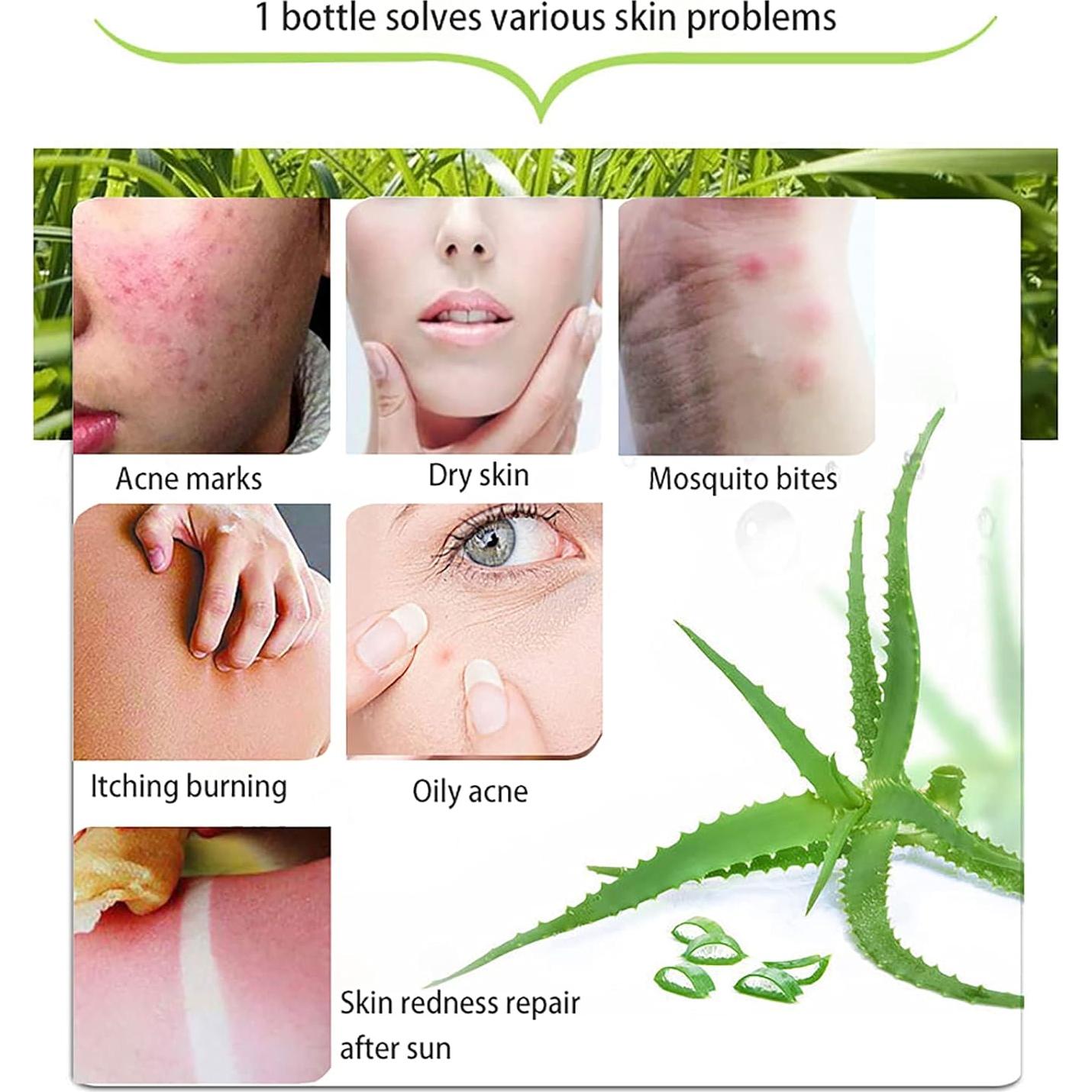 Gel Natural de Aloe Vera ASYBO 300ml x 2 - Hidratante y Calmante