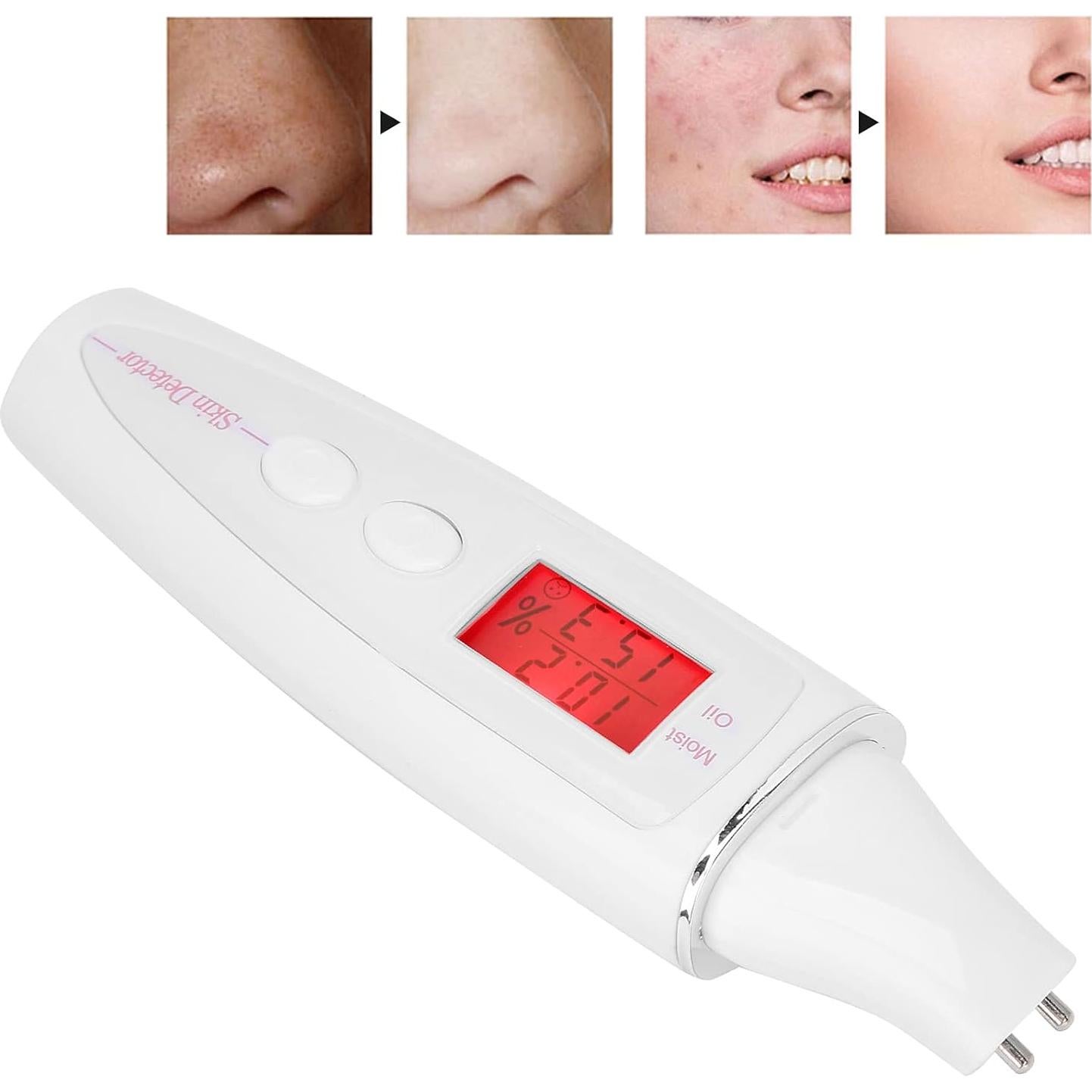 Analizador de Piel Facial Dioche LCD Digital Agua y Aceite