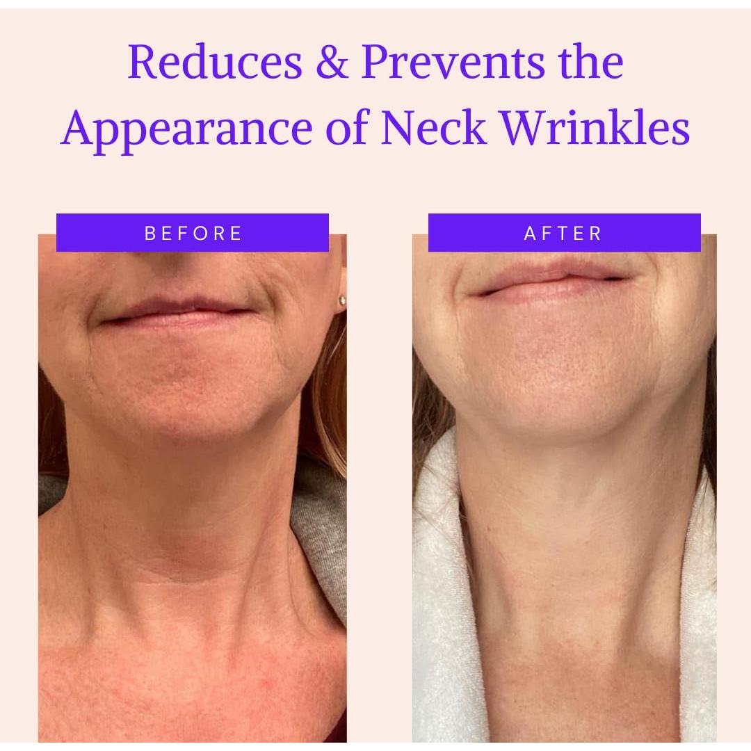 Parches Antienvejecimiento Blumbody para Cuello - Silicona Reutilizable