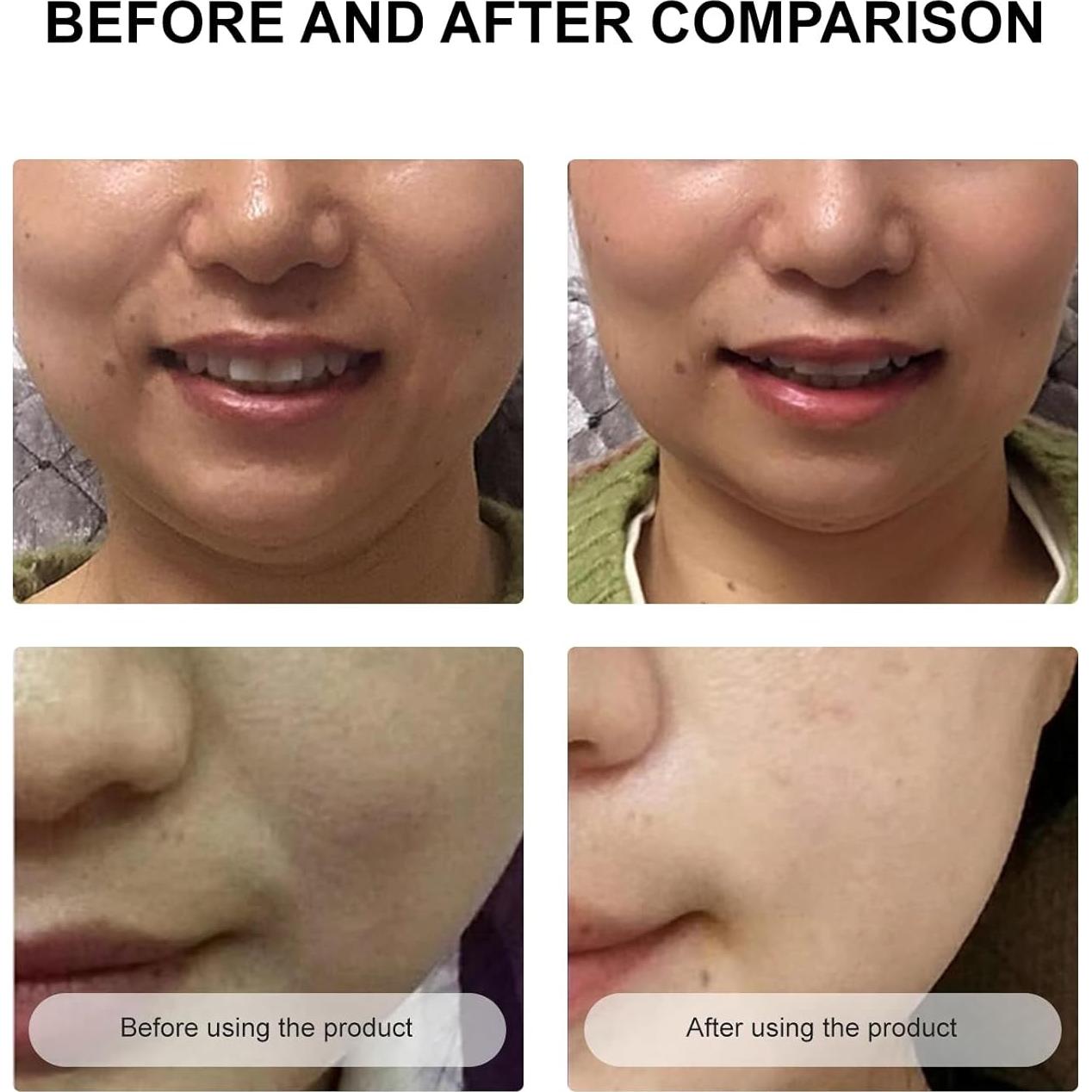 Mascarillas Faciales Antienvejecimiento Secret Strips - 10 Pares