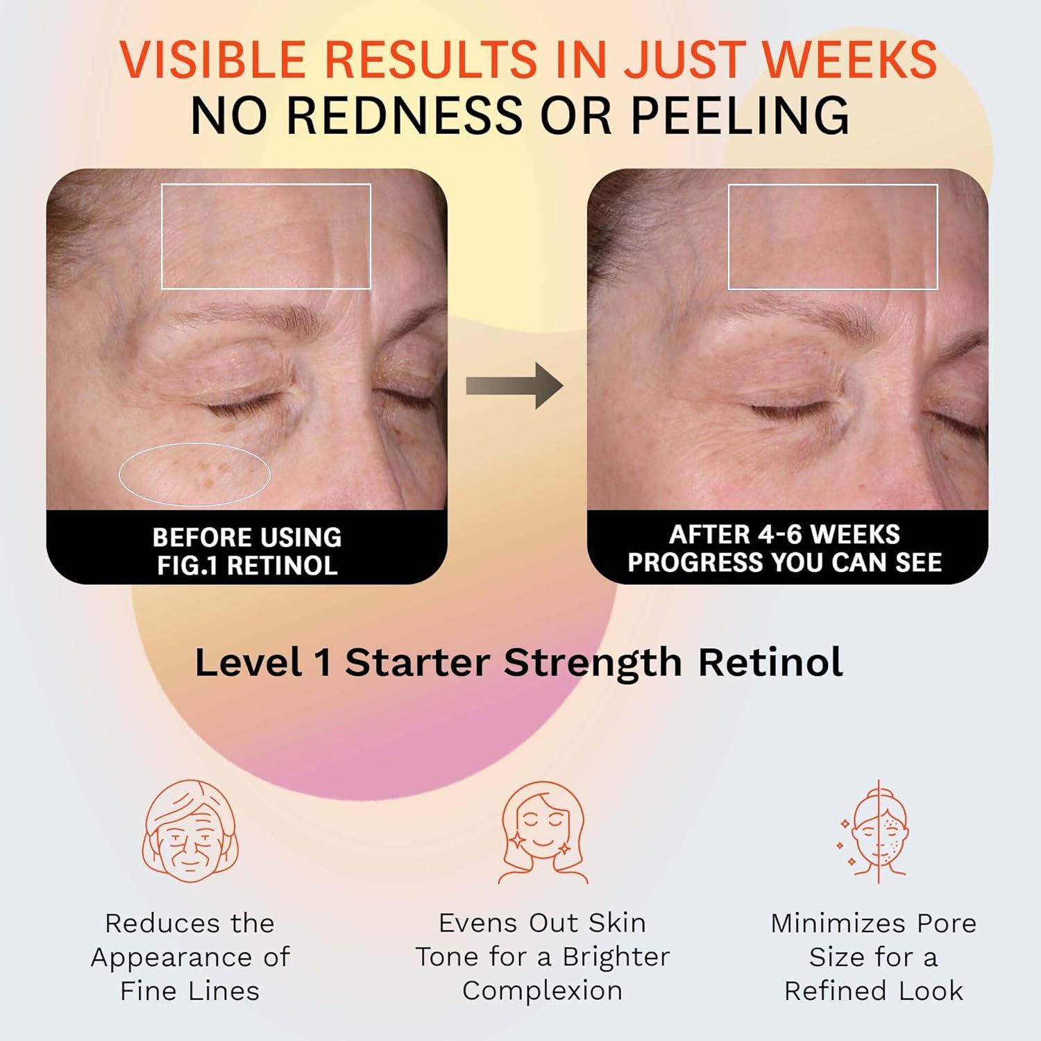 Crema Nocturna de Retinol Fig.1 50ml - Hidratante Facial Antiarrugas