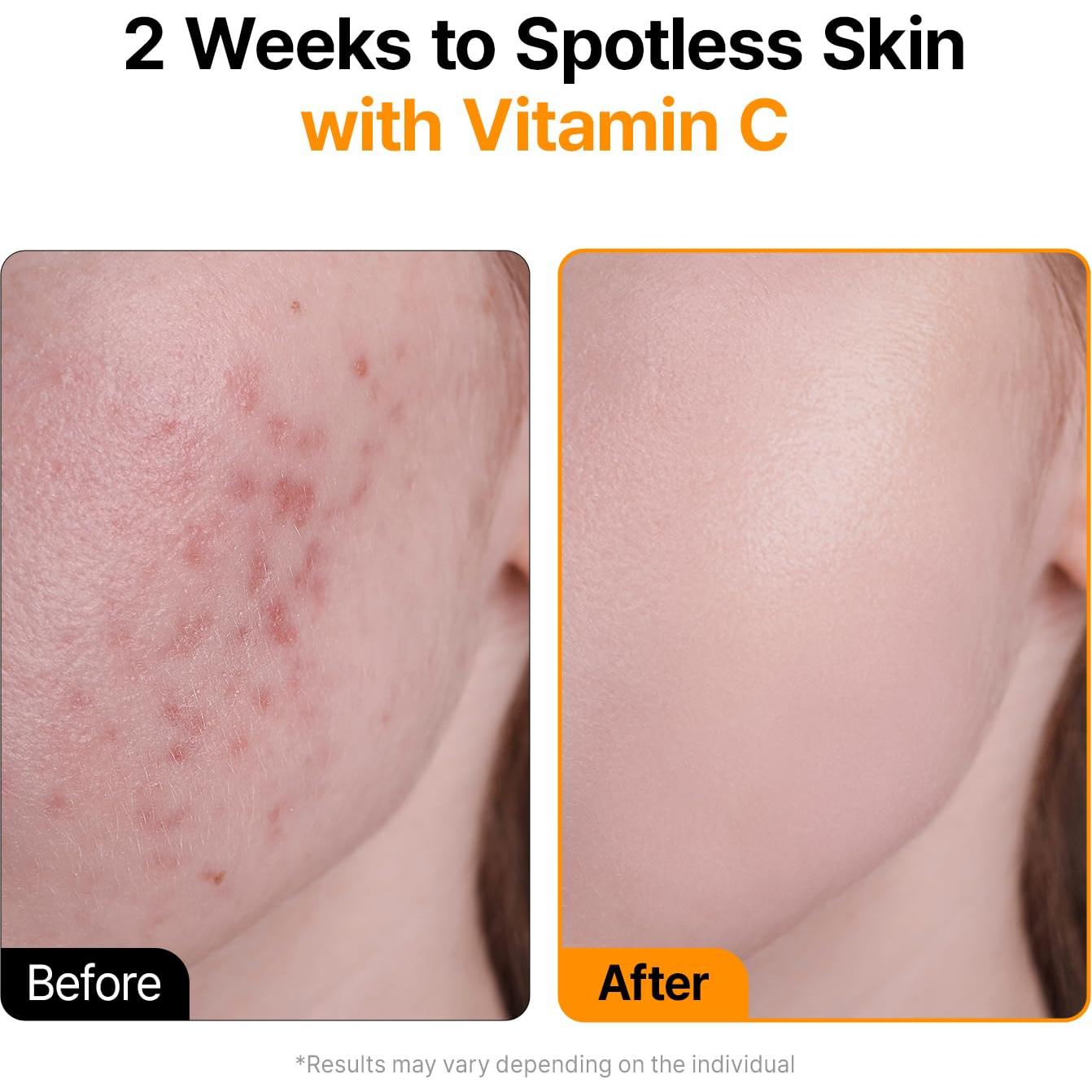 Ampolla Serum Vitamina C Boostlab 14.79 ml - Cuidado Piel Vegano