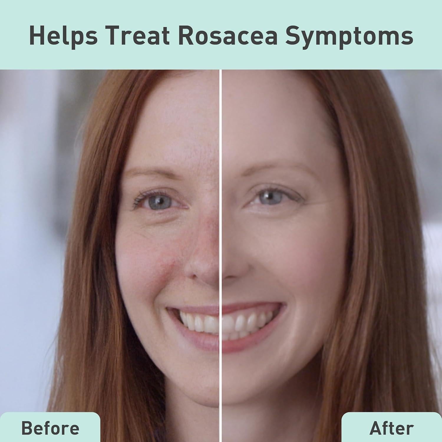 Suero Facial PROcure Rosacare 32ml - Hidratante para Rosácea