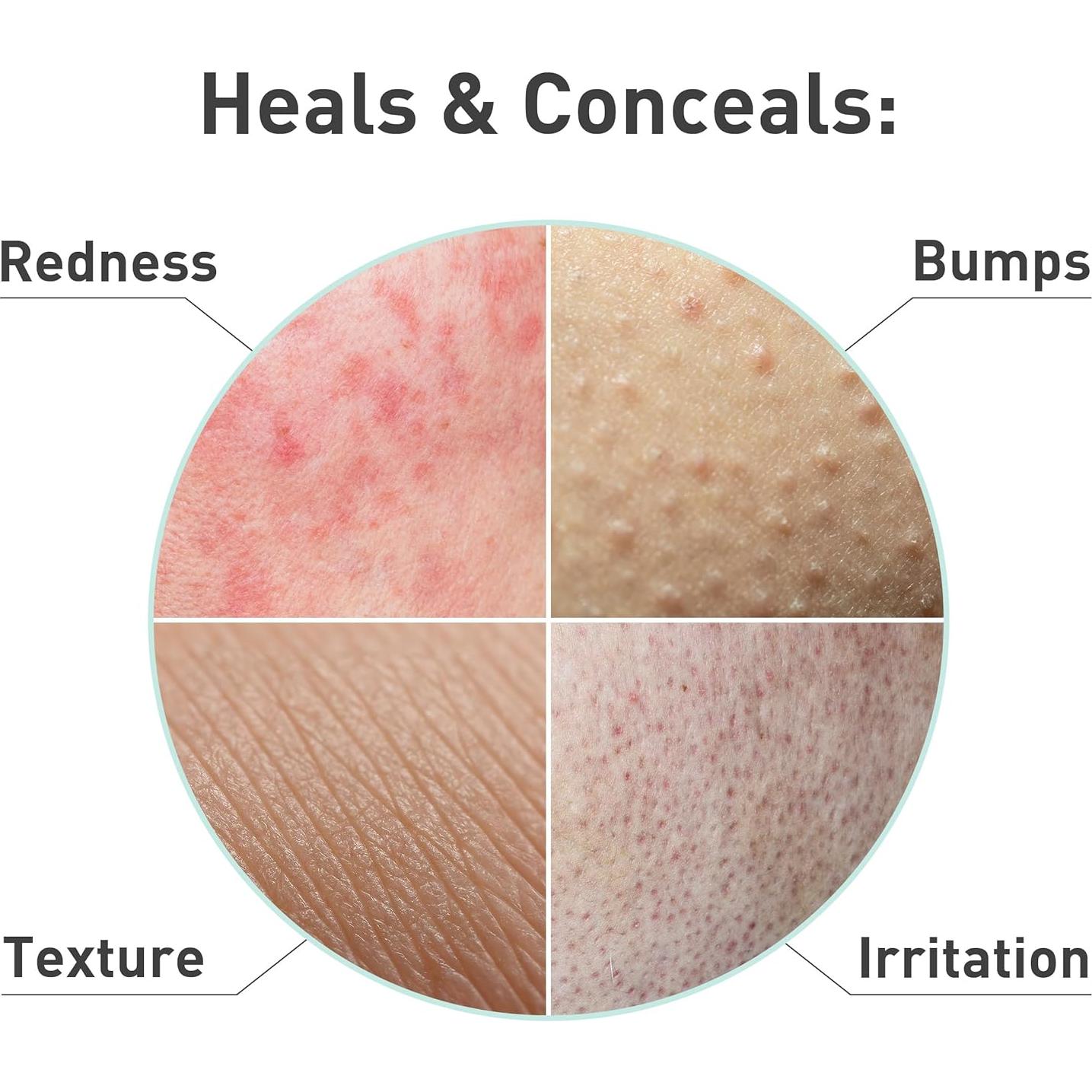 Suero Facial PROcure Rosacare 32ml - Hidratante para Rosácea