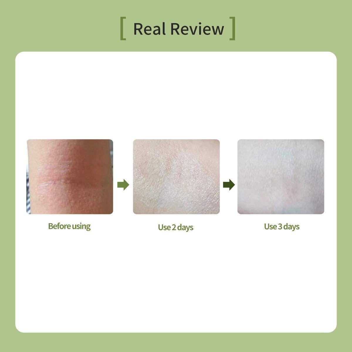 Crema Hidratante Ato Barrera 120ml - Piel Sensible y Atópica