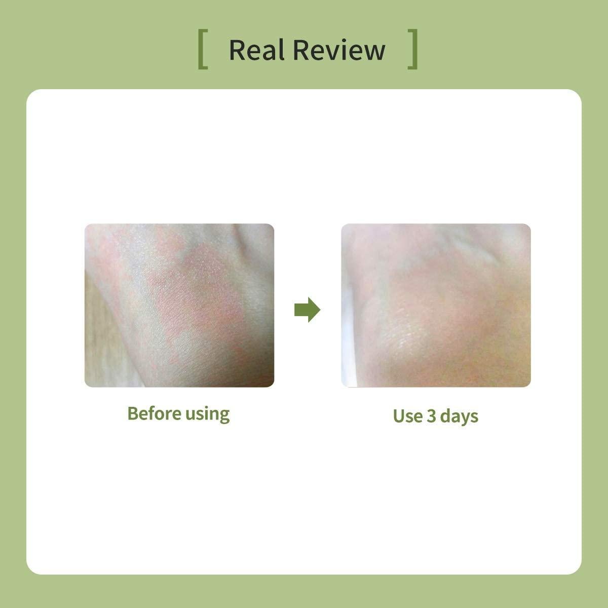 Crema Hidratante Ato Barrera 120ml - Piel Sensible y Atópica