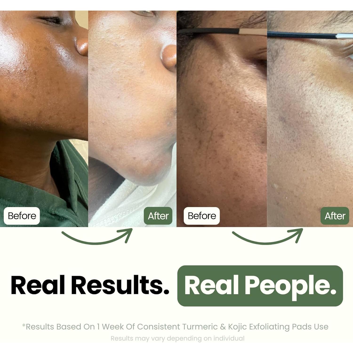 Discos Exfoliantes Naturales Ola Honi con Cúrcuma y Ácido Kójico - 30 Unidades