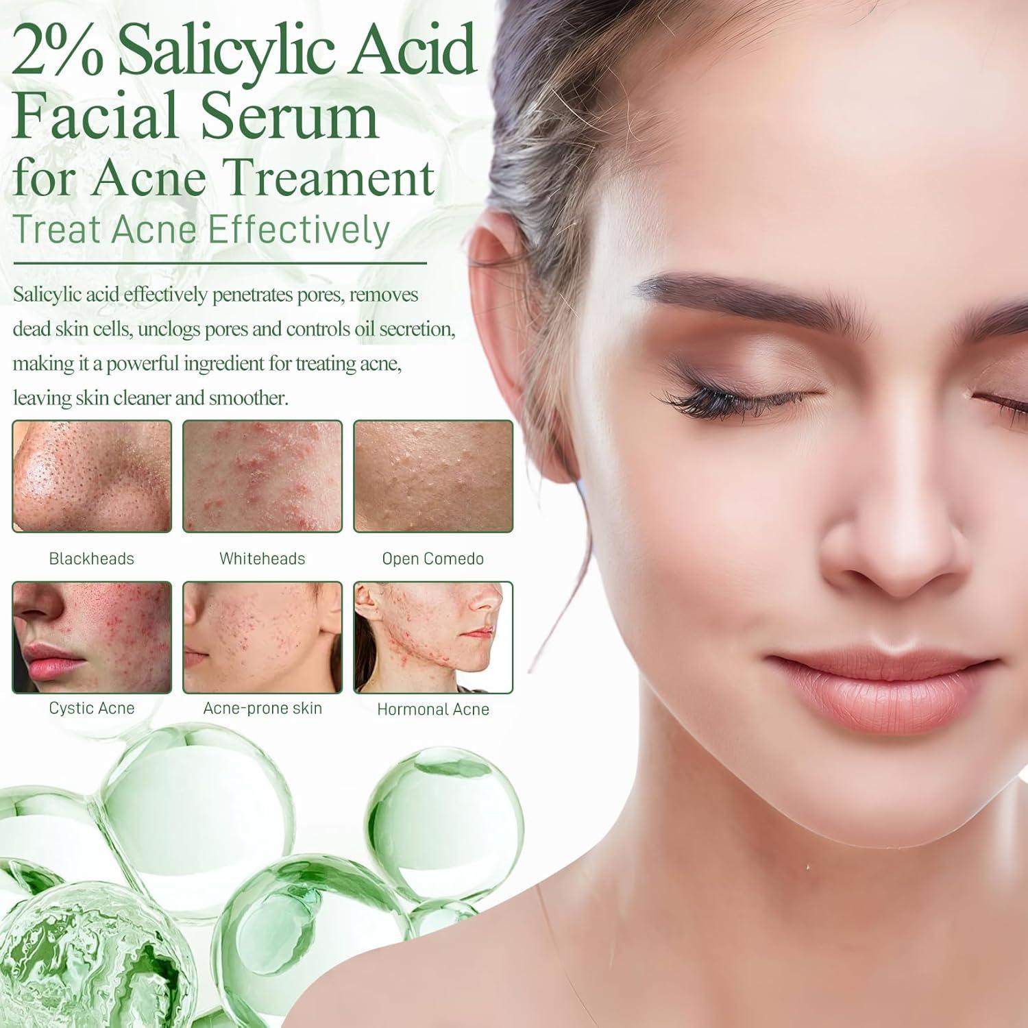 Suero Facial Onkessy 29.57 ml - 2% Ácido Salicílico y Niacinamida