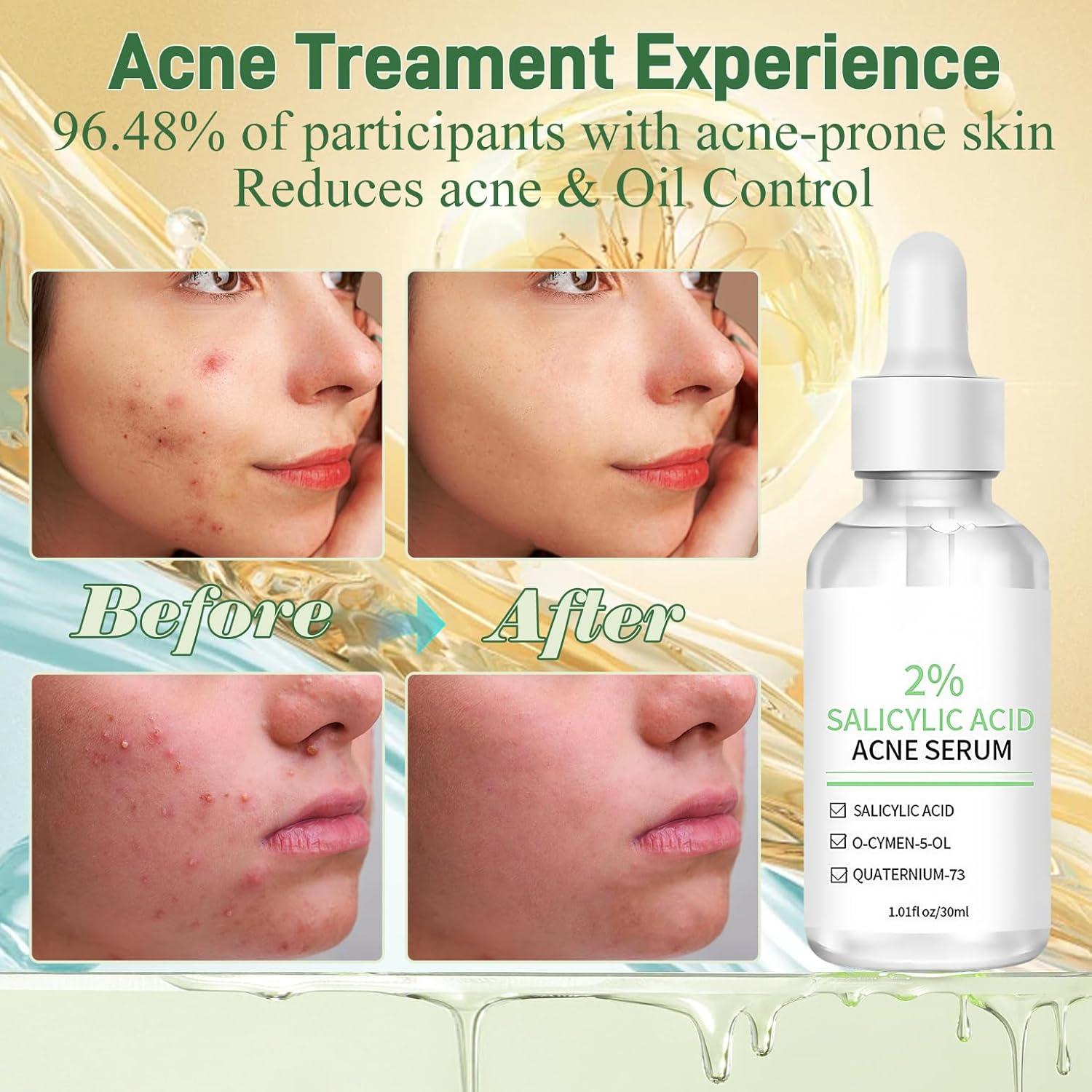 Suero Facial Onkessy 29.57 ml - 2% Ácido Salicílico y Niacinamida