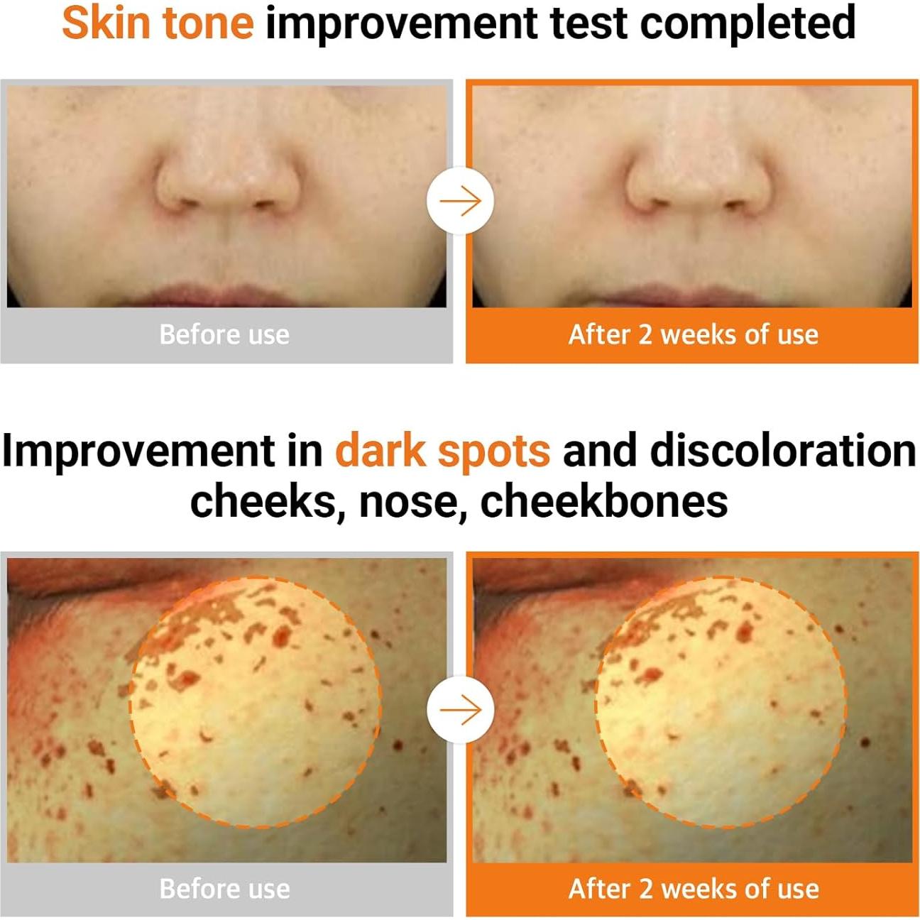 Ampoule Vita PDRN Neaf 20ml - Vitamina C y Regaliz para Piel Radiante