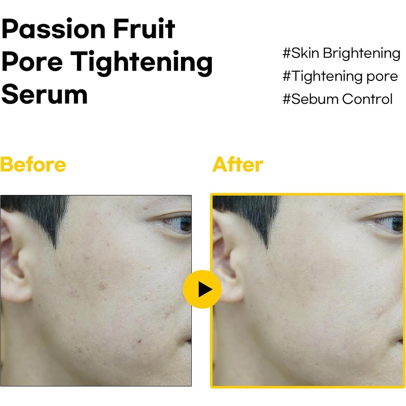 Suero Astringente de Maracuyá BBH 49.9ml - Minimiza Poros Natural