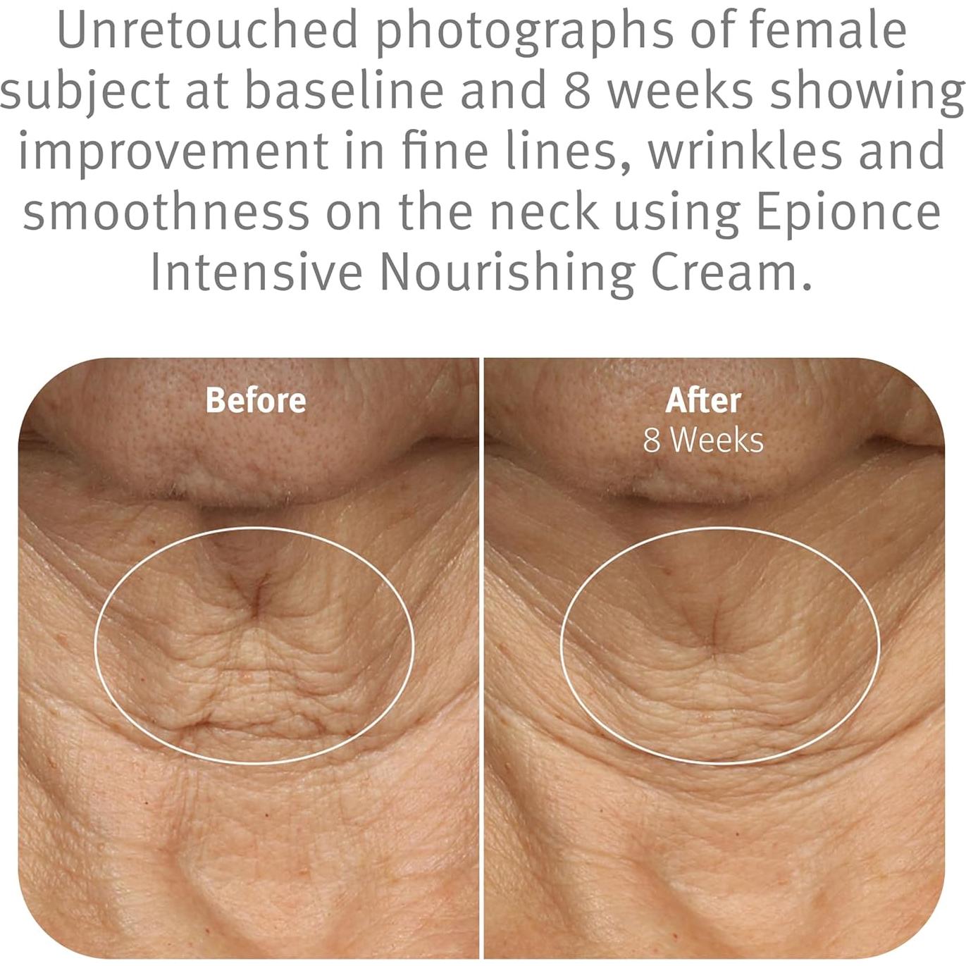 Crema Nutritiva Intensiva Epionce 50ml - Hidratante Antienvejecimiento